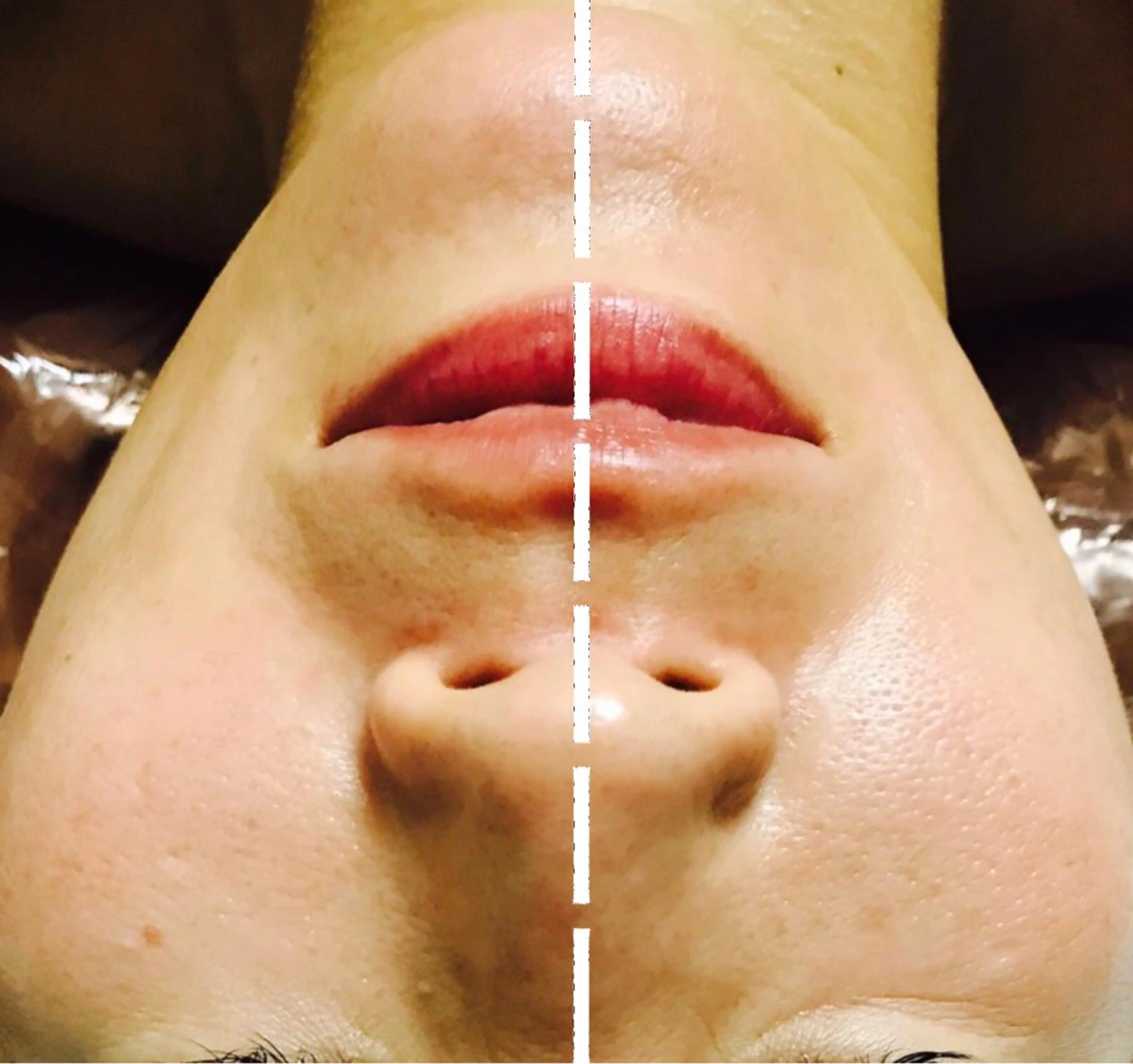 エステ 小顔専門店 桜Bisucuitのエステ・リラクイメージ