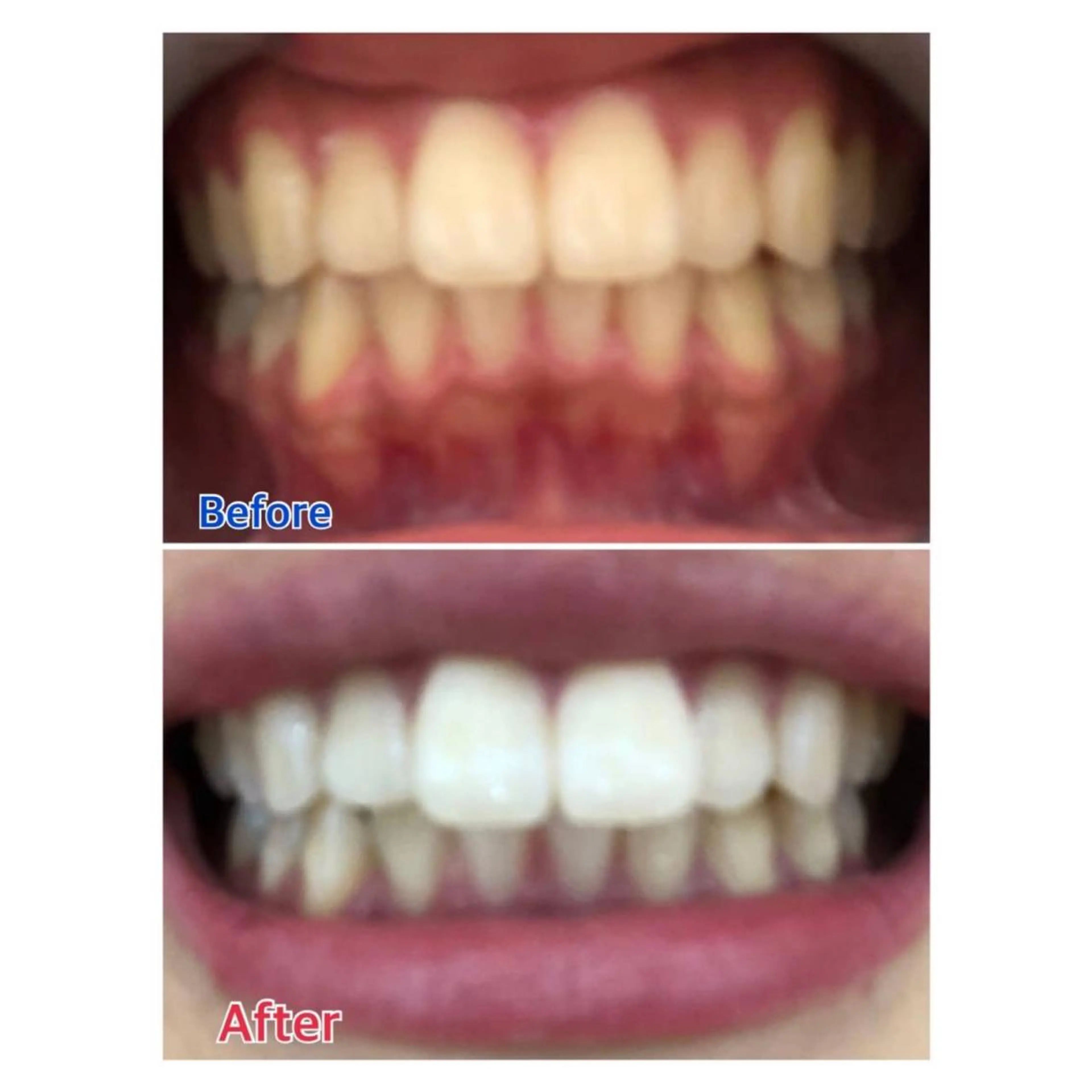 MBEAUTYSALON 千葉店・京成大久保所属・Melty 輝のその他イメージ