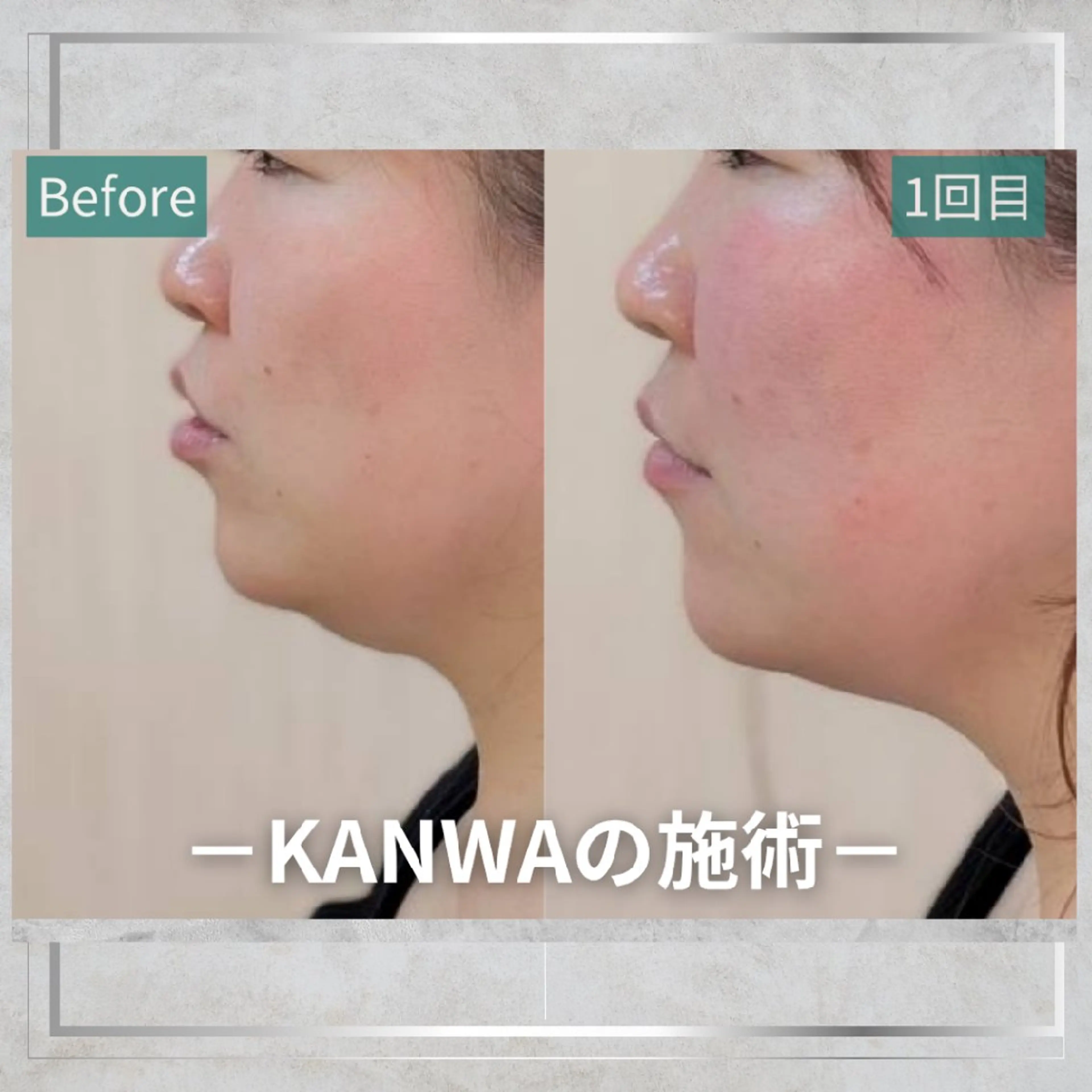 KANWA 鍼灸院のエステ・リラクイメージ