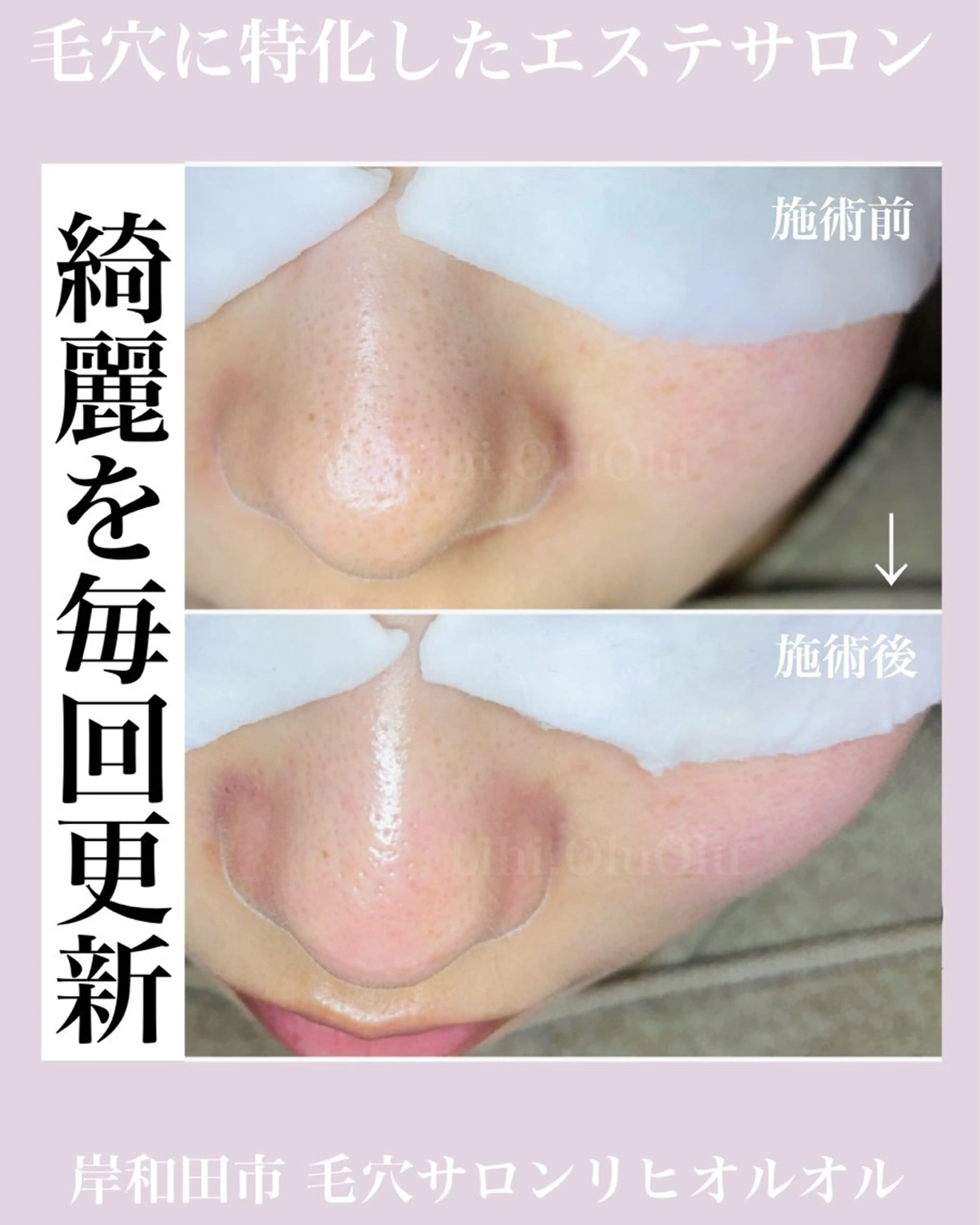 毛穴汚れ改善専門店/ 岸和田/リヒオルオルのエステ・リラクイメージ