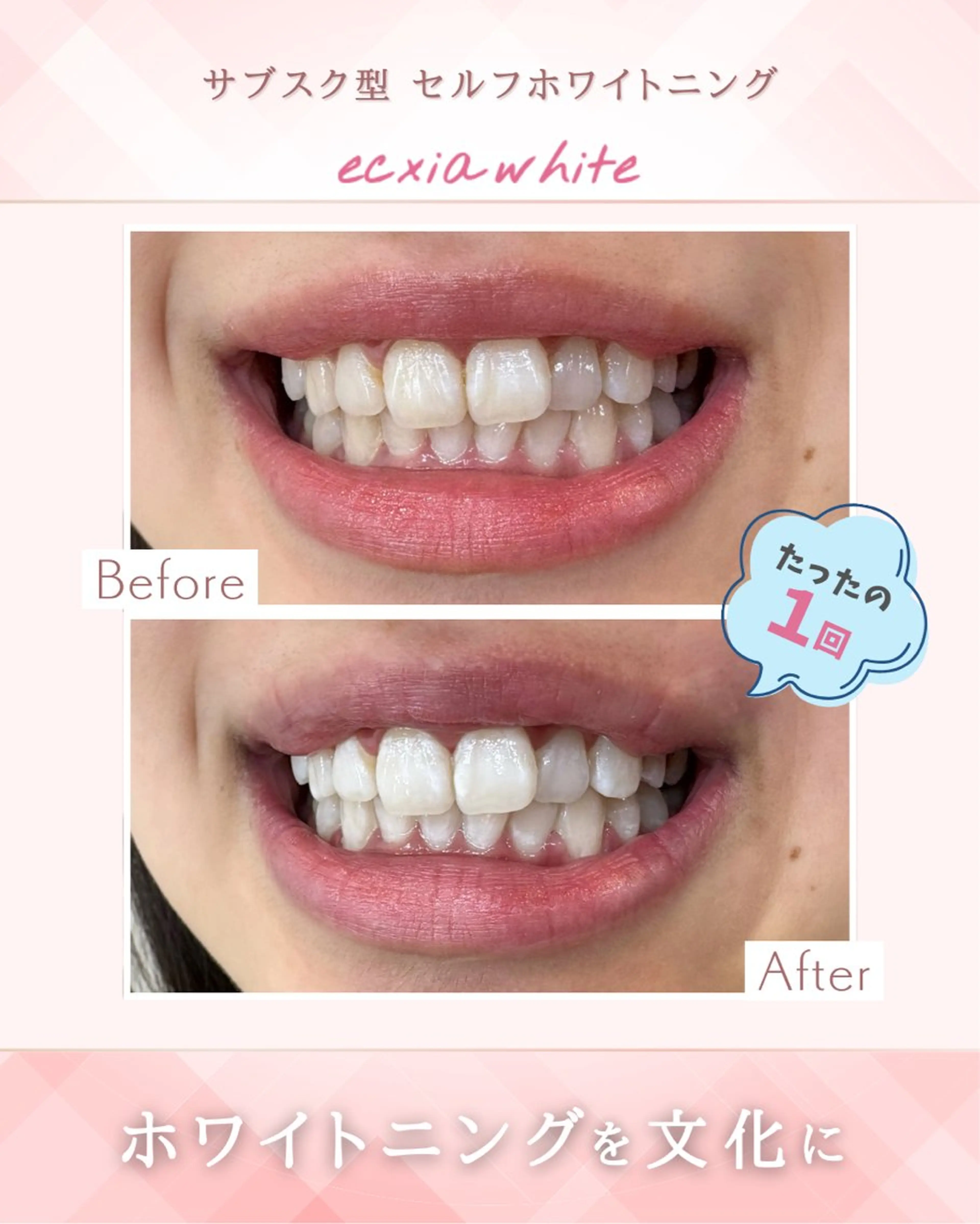 セルフホワイトニング エクシア大阪天王寺店のその他イメージ