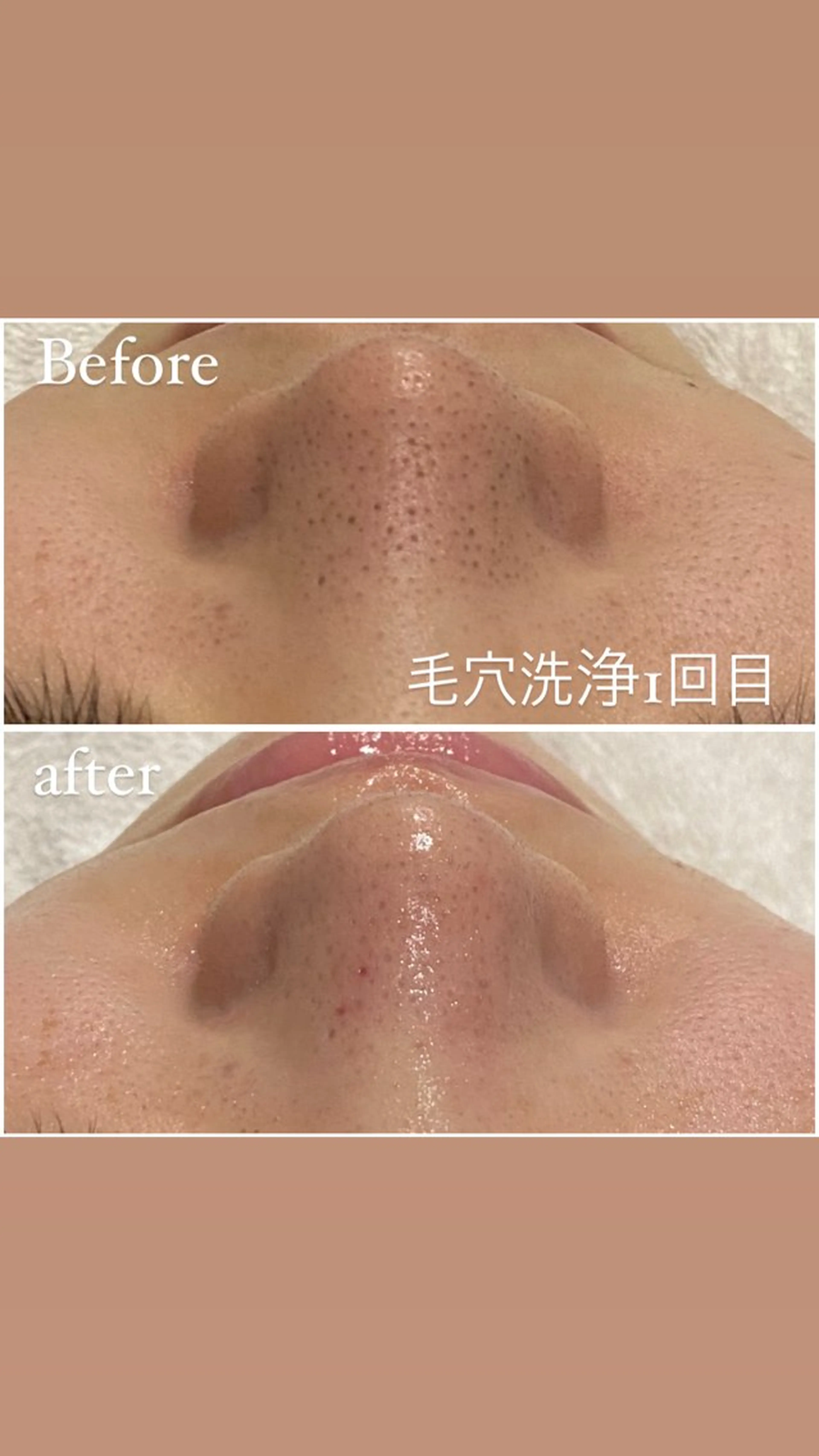 エステ 毛穴洗浄・痩身・脱毛 /アルカンジュのエステ・リラクイメージ