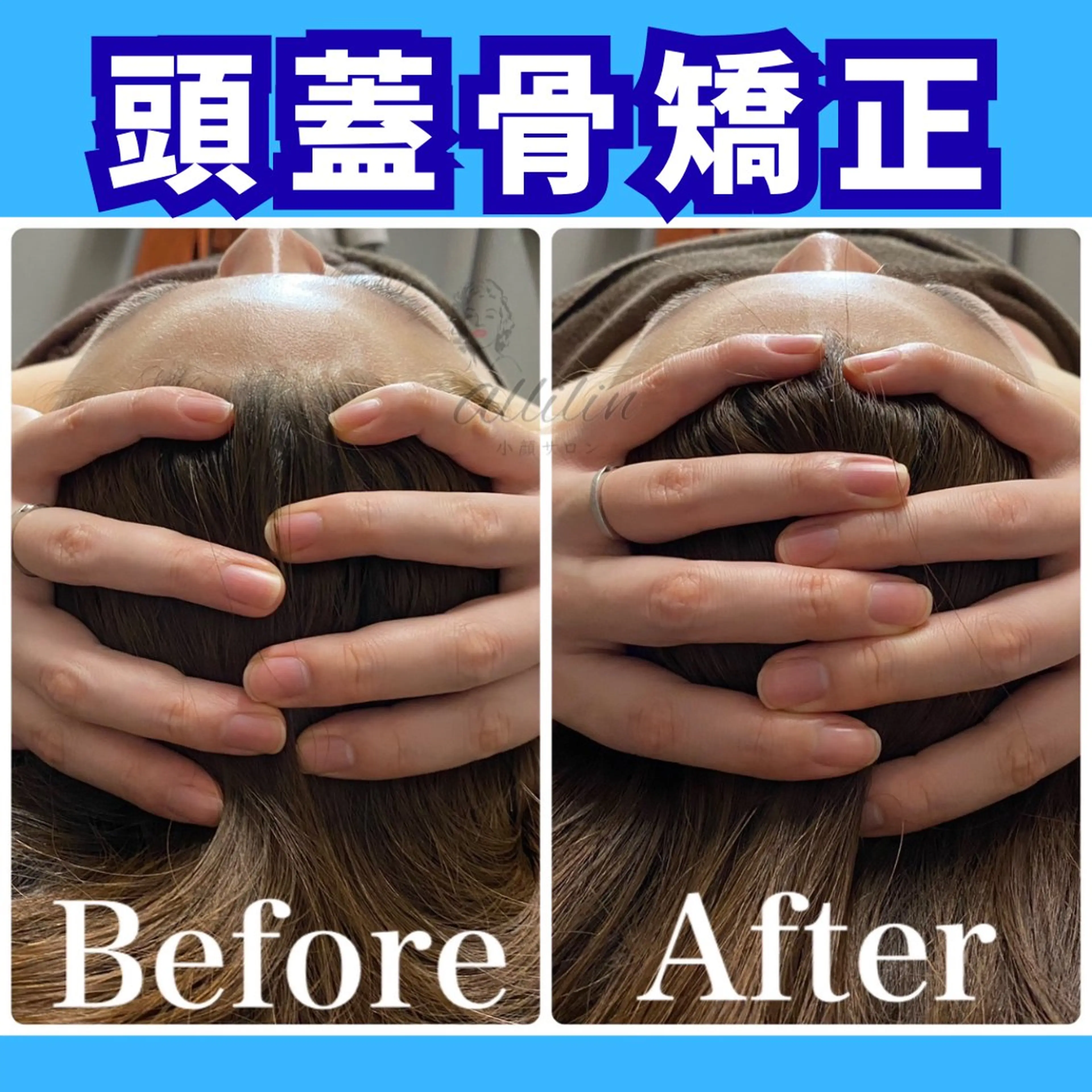 💛頭蓋骨矯正×上半身筋膜リリースストレッチ50分💛※メイク落とし不可の方はこちらがおすすめの写真