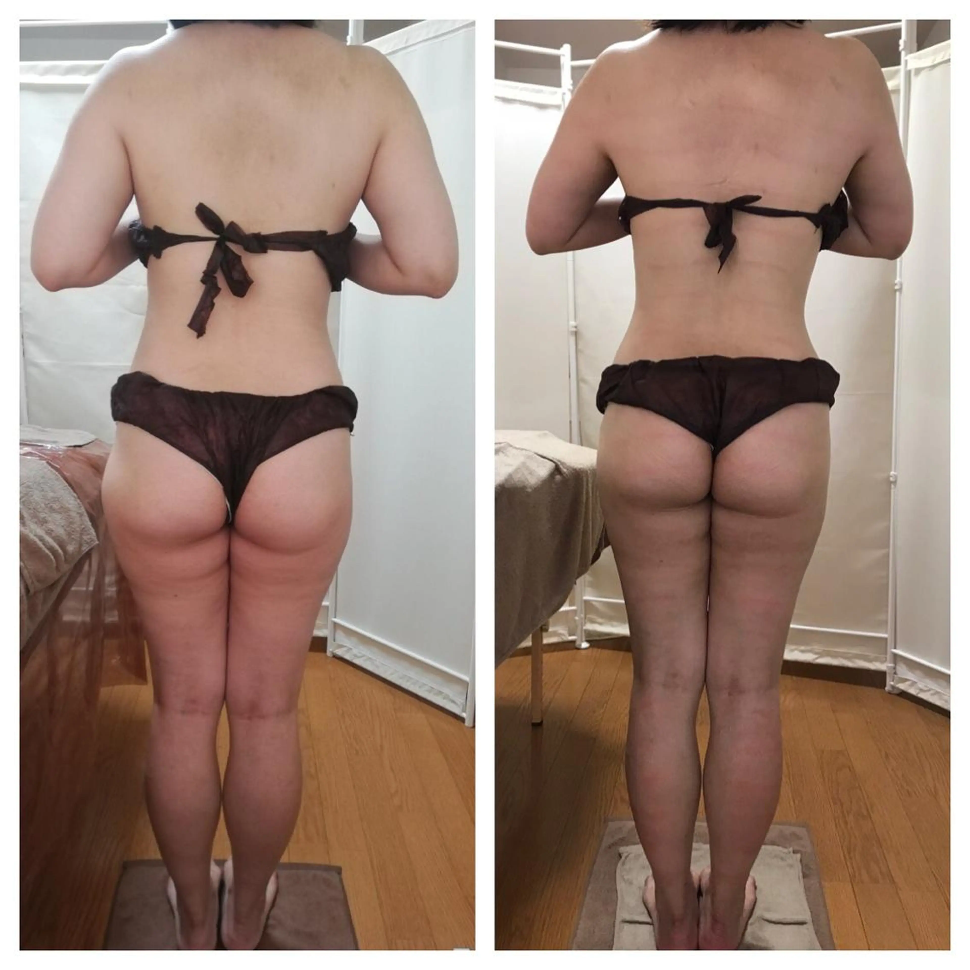 《本気痩せ×疲労改善 》  BILOOPのエステ・リラクイメージ