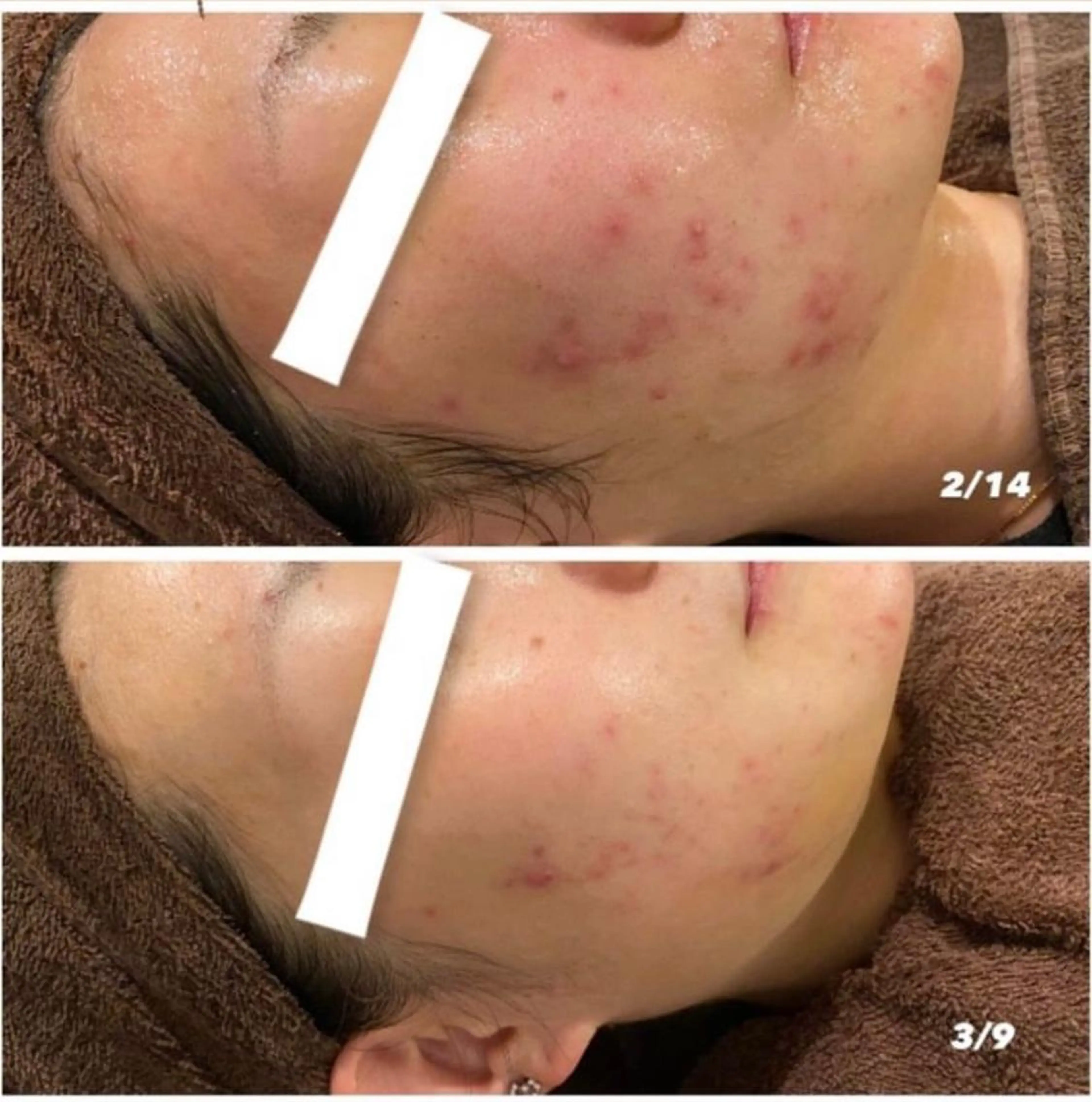 本気の肌質改善スキン デトックス🌿のエステ・リラクイメージ