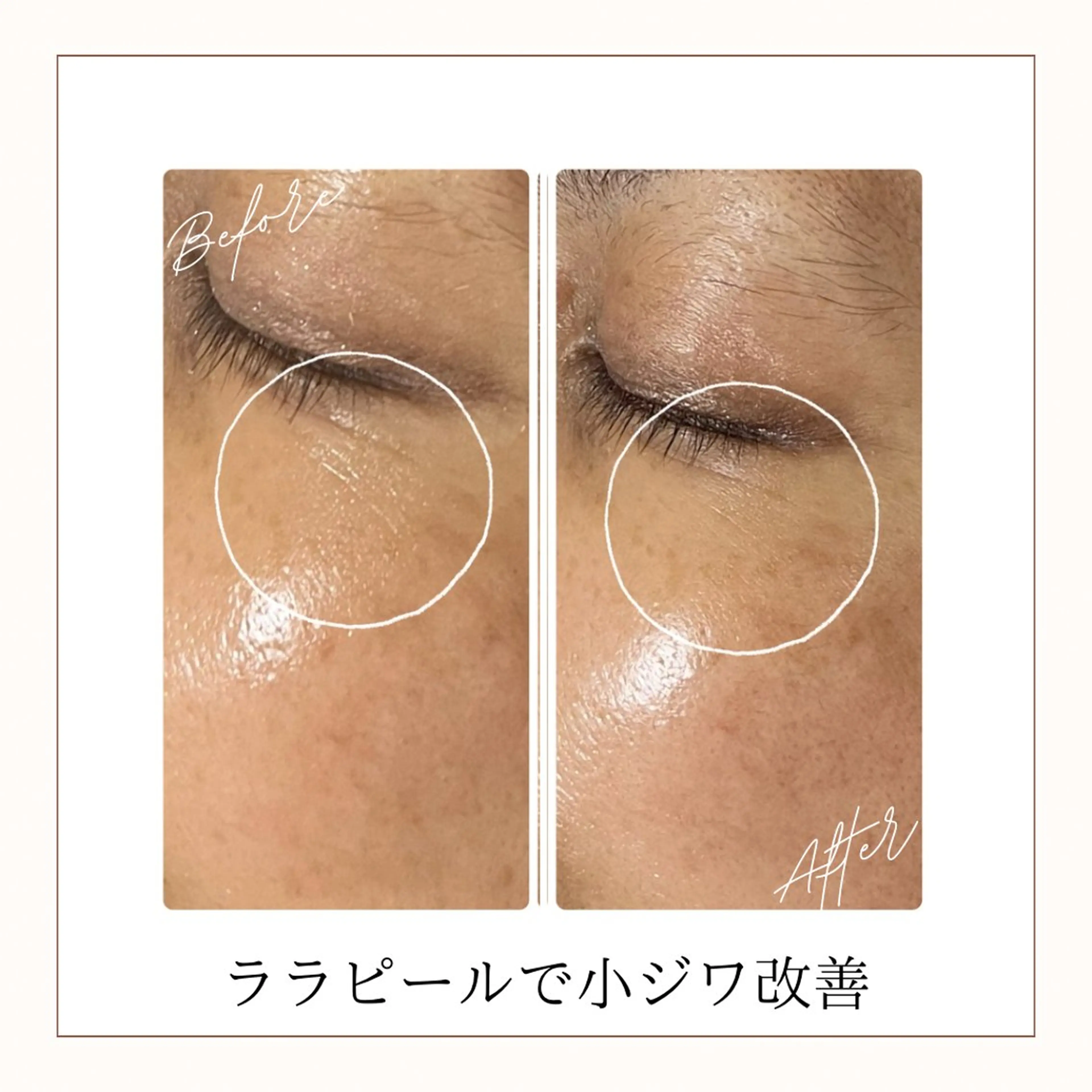 M.riche エムリシェのエステ・リラクイメージ