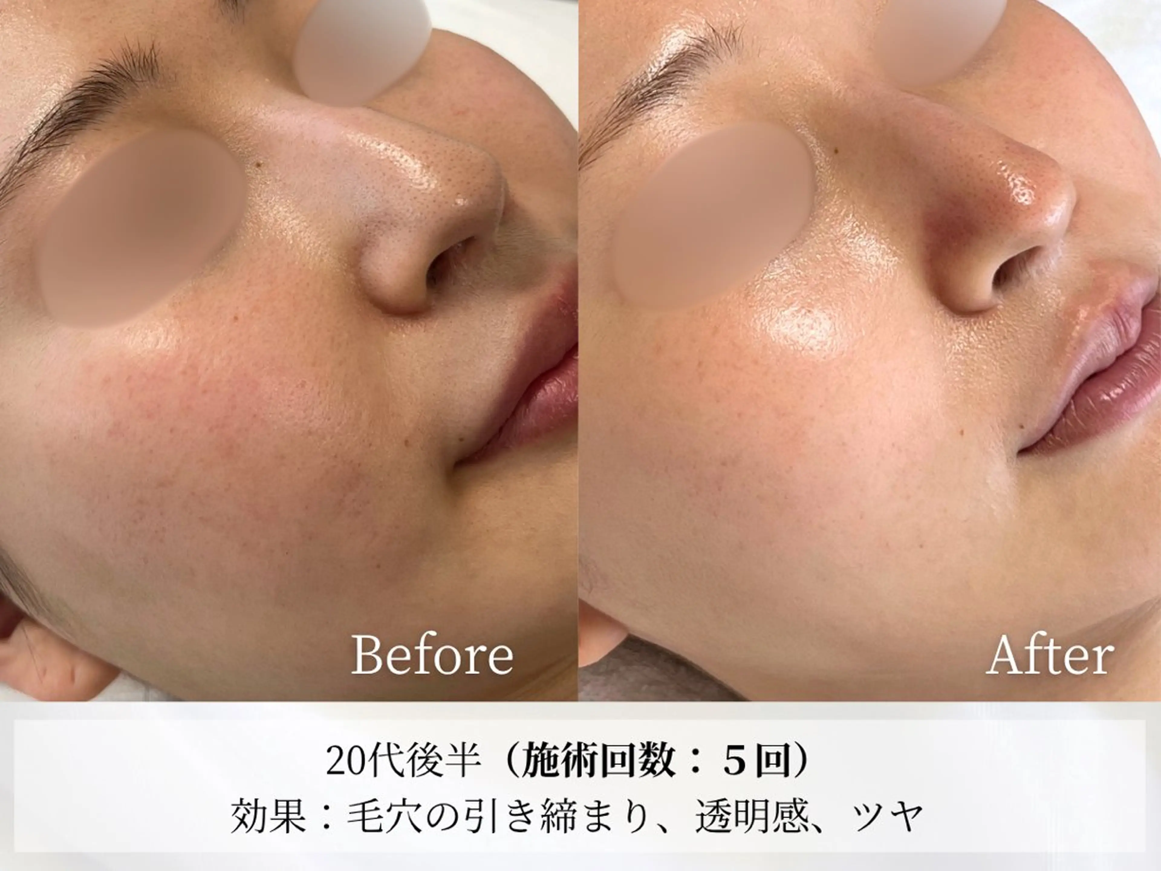 Astorie SHIORIのエステ・リラクイメージ