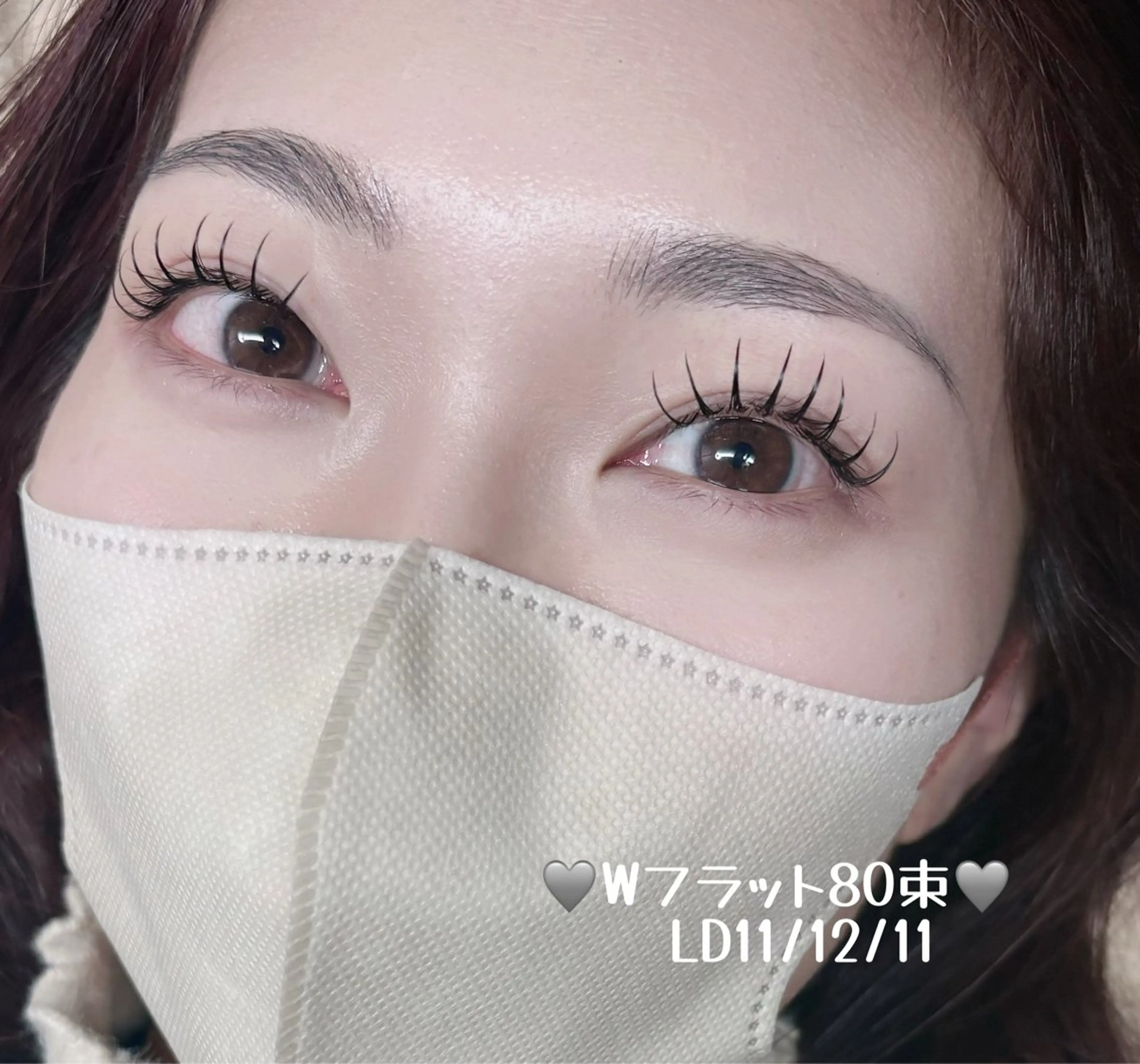 バインドロック(Wフラット)80束(160本)の写真