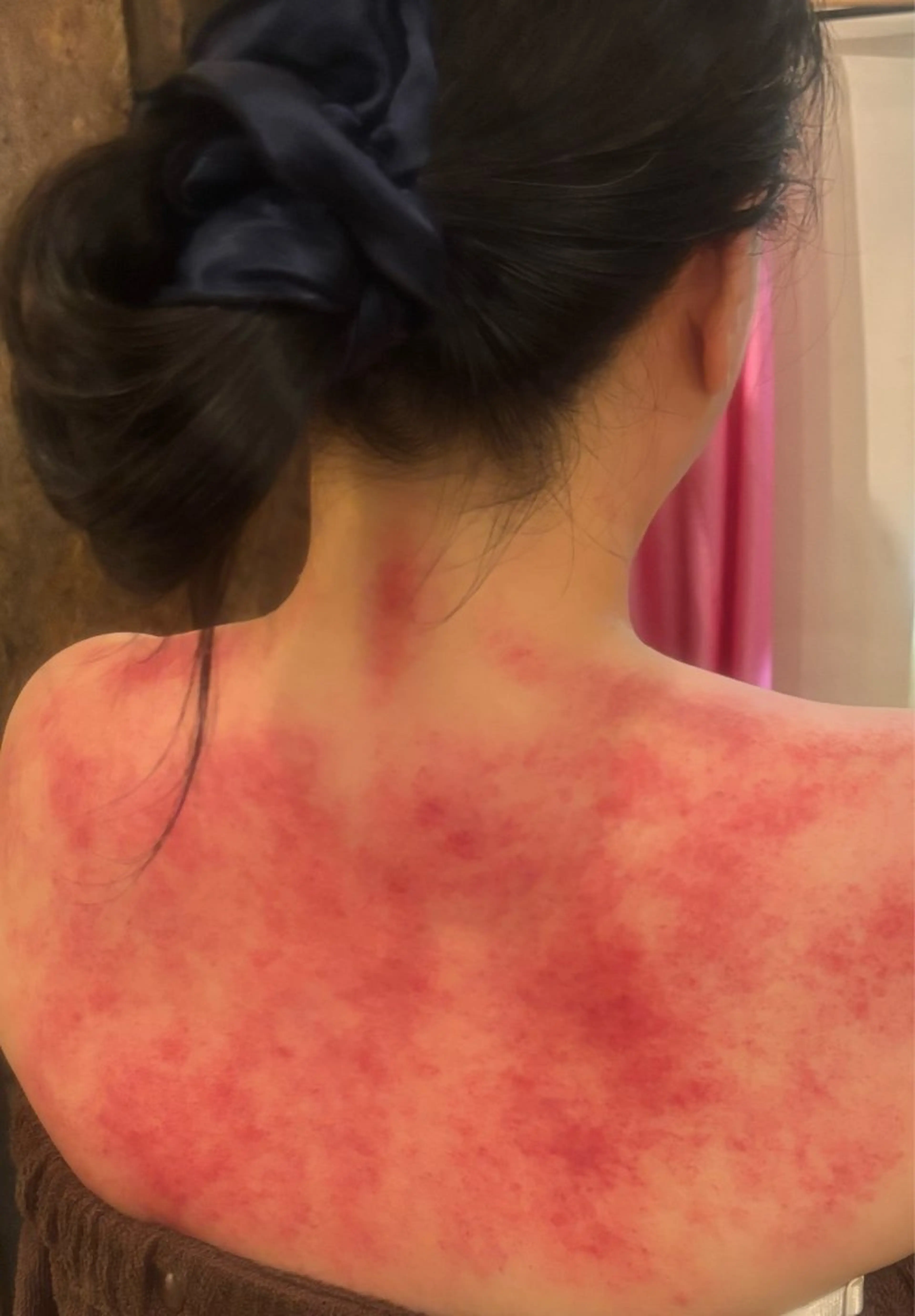 【体験、お試し】オリジナル刮痧　ショートコース(かっさ＆ほぐしMIX  全身　約90分、足湯付き)の写真