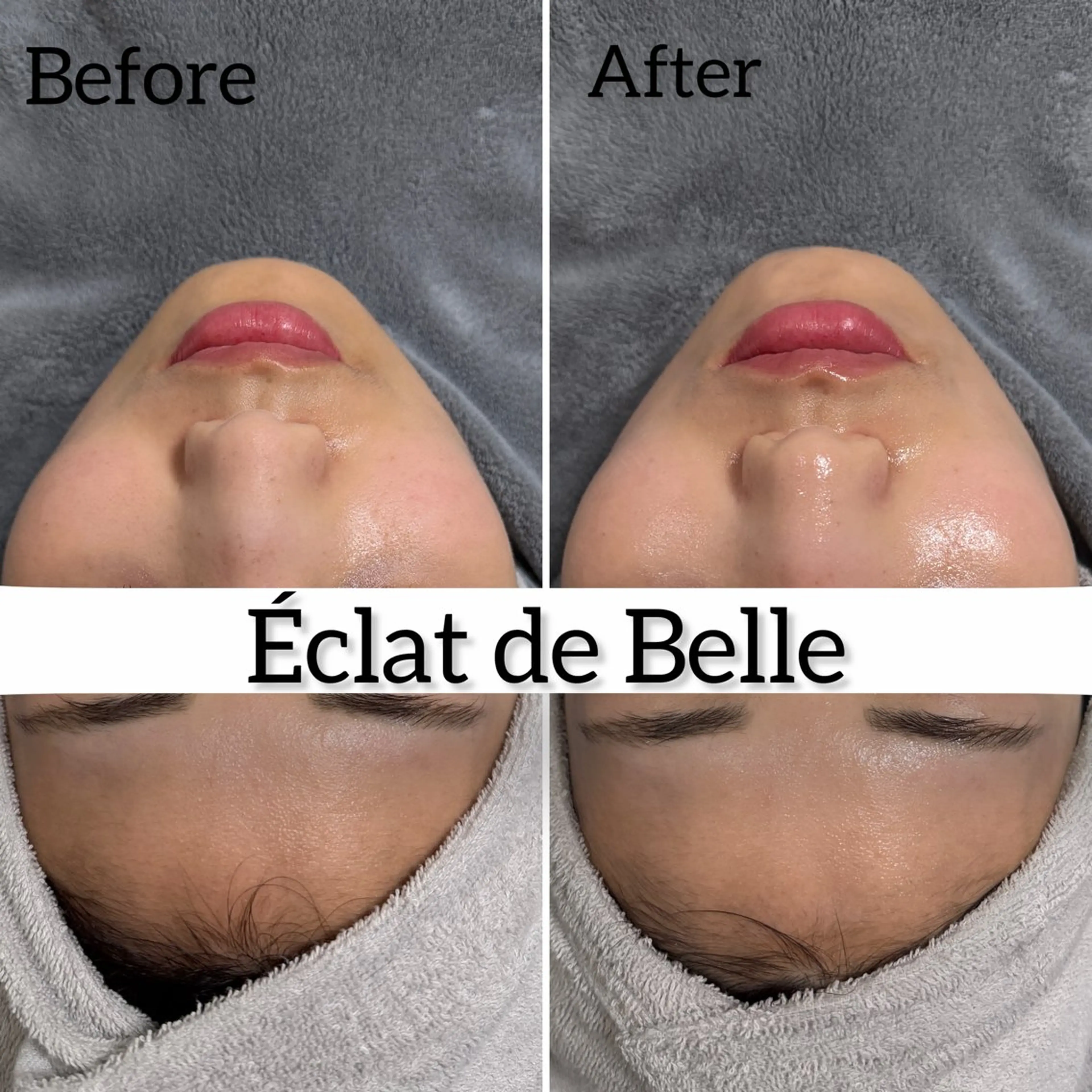 その他 Éclat de Belle🫧白玉肌のその他イメージ