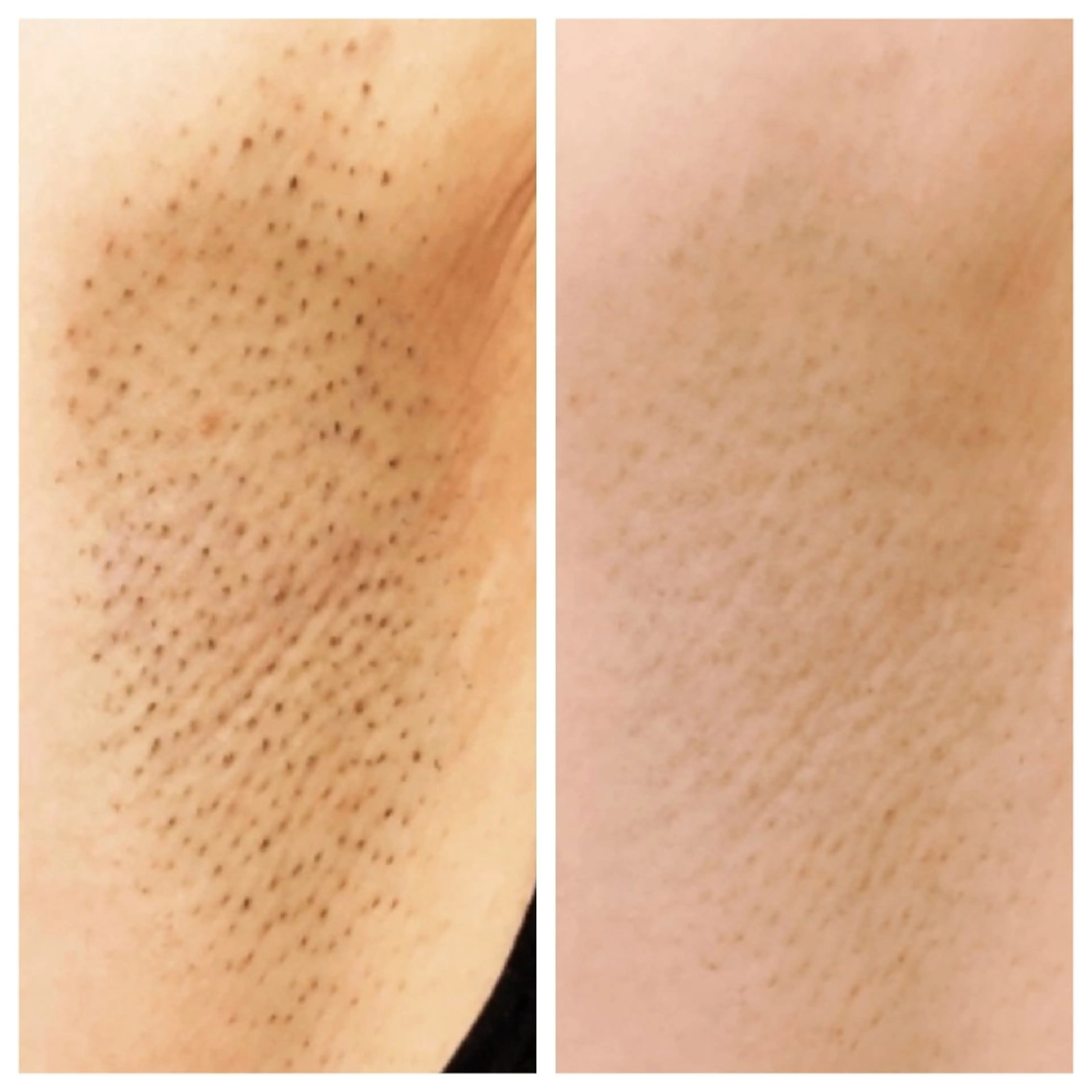 エステサロン LYSHのその他イメージ