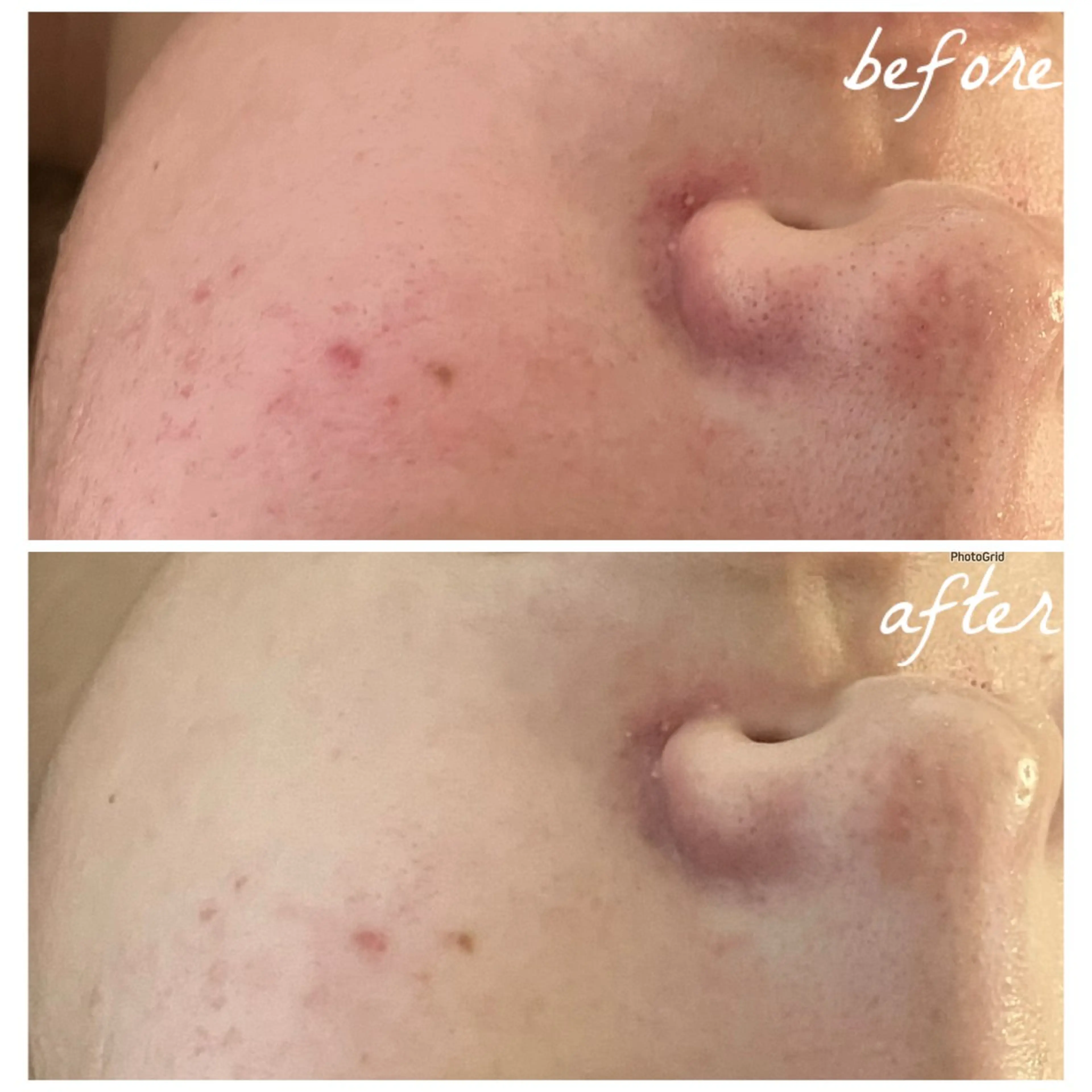 メンズ エステ メナード岐阜茜部 杉浦のエステ・リラクイメージ