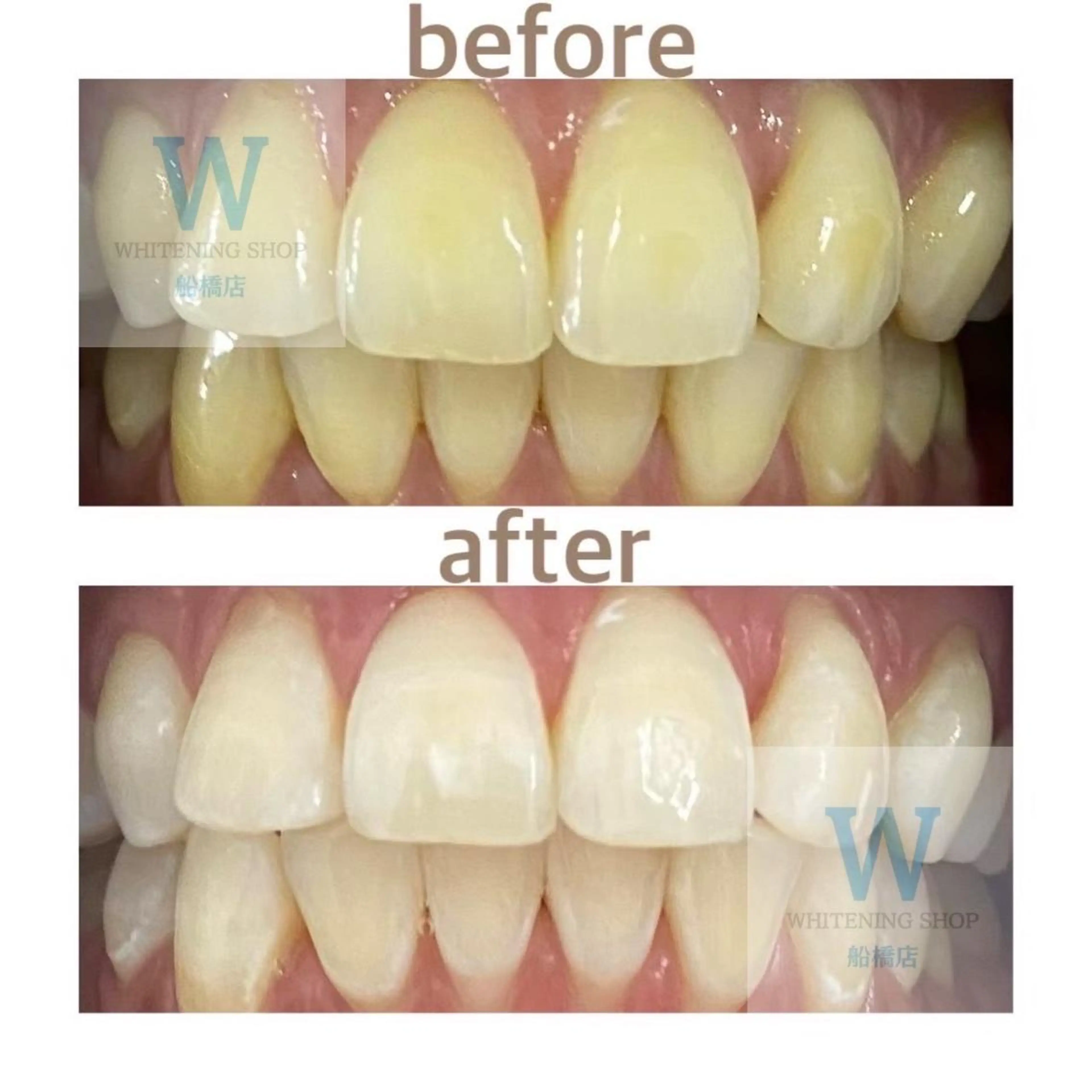 ホワイトニング ショップ船橋店🦷のエステ・リラクイメージ