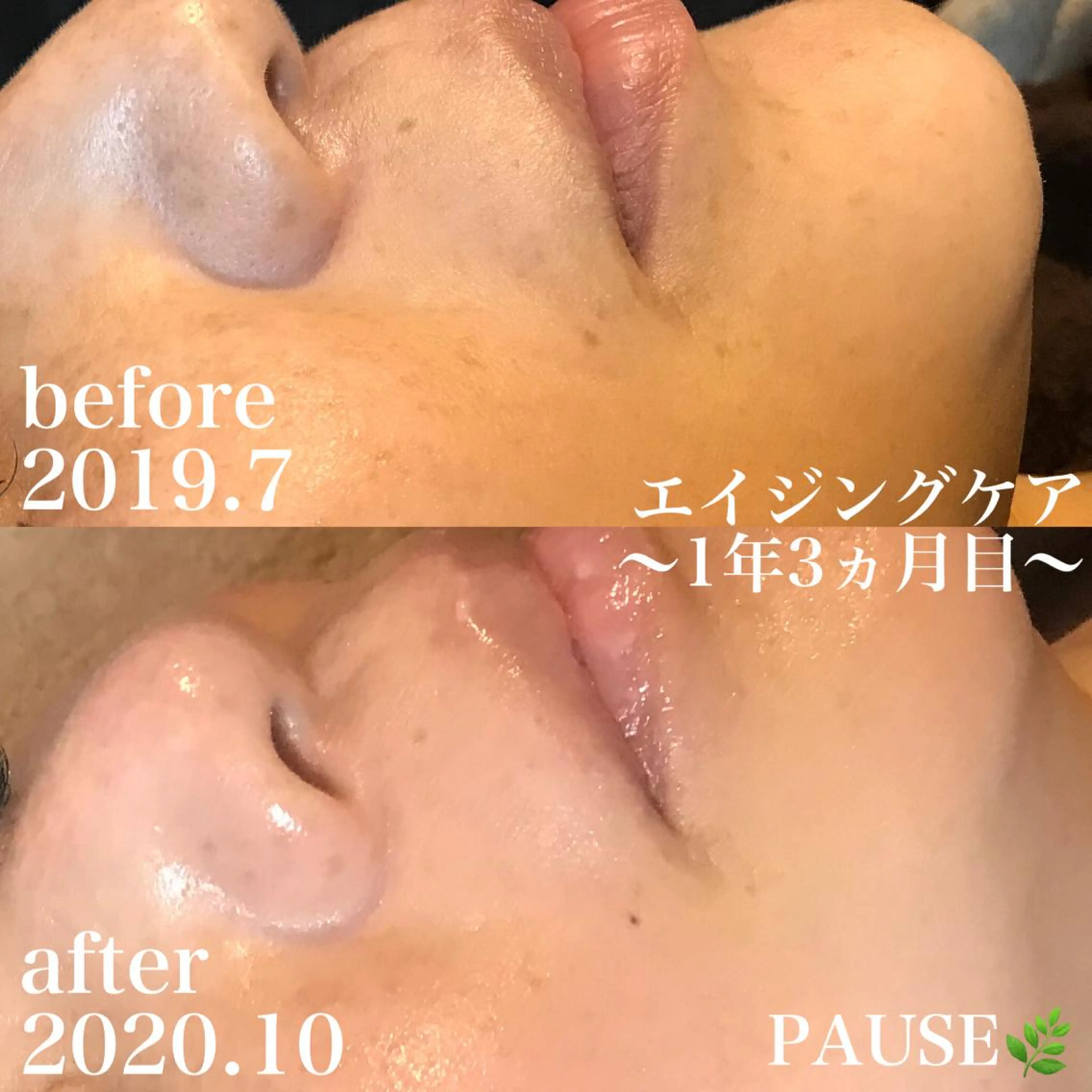 エステ 浜野 恵美のエステ・リラクイメージ