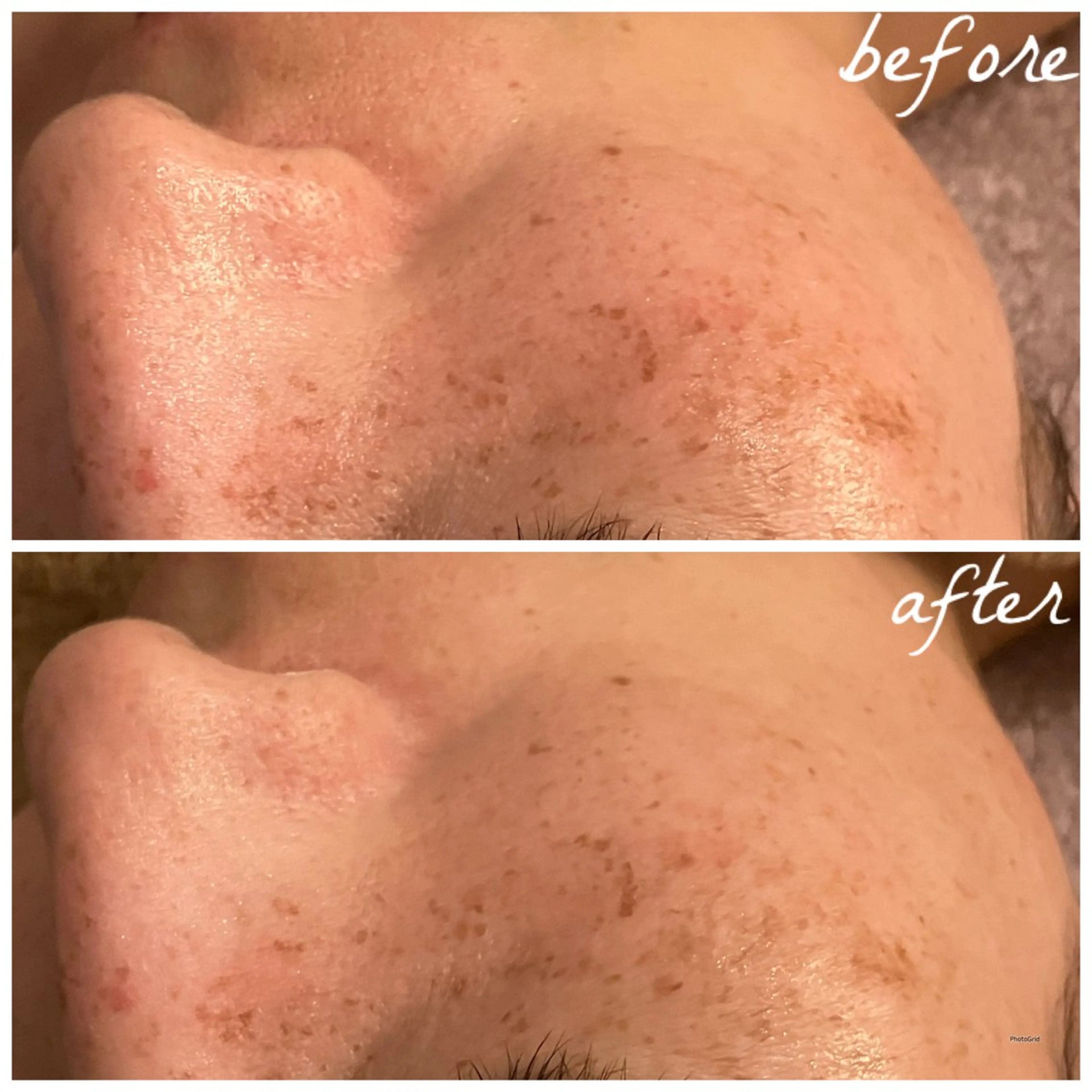 メンズ エステ メナード岐阜茜部 杉浦のエステ・リラクイメージ