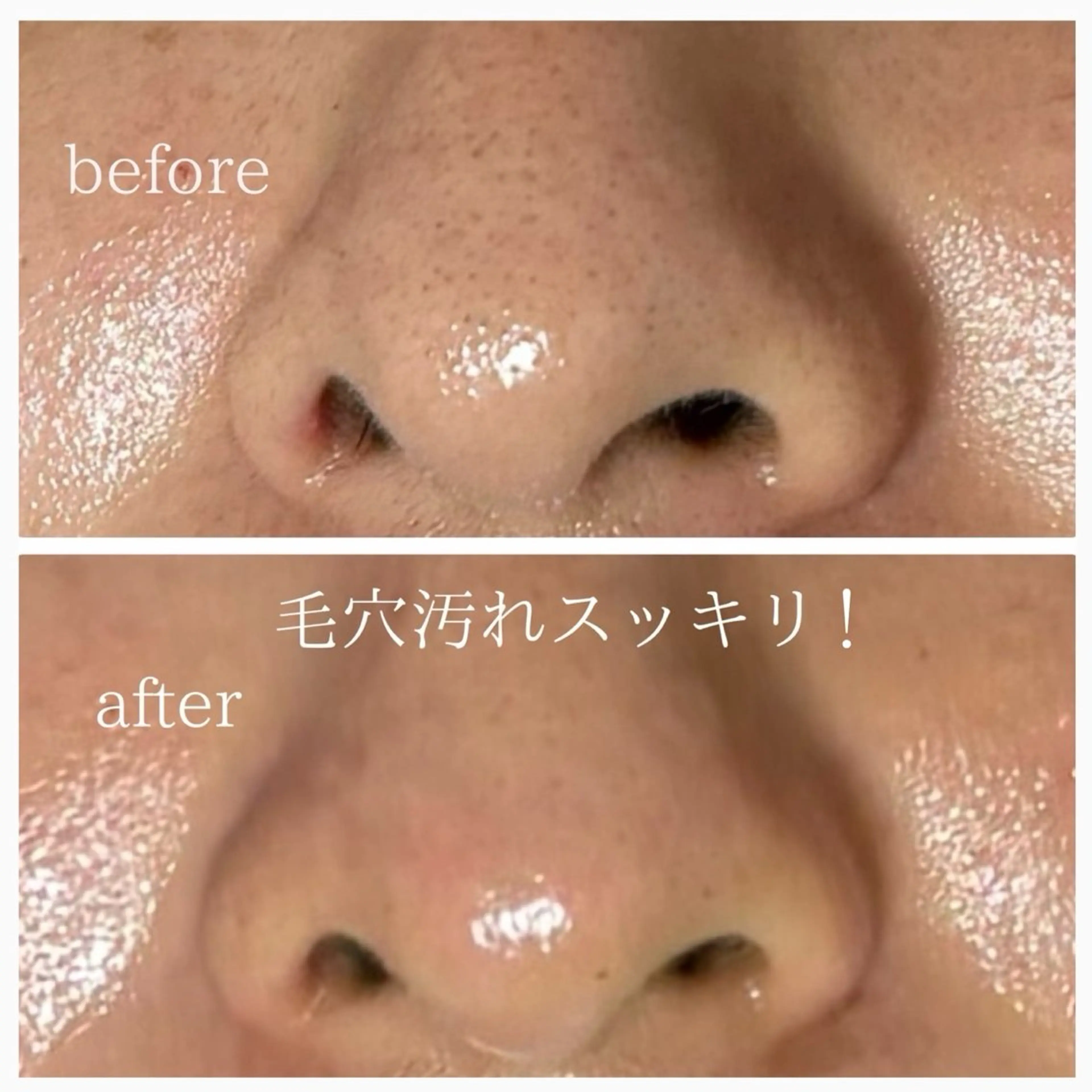 ハーブピーリング・ Mikaのメニューのエステ・リラクイメージ