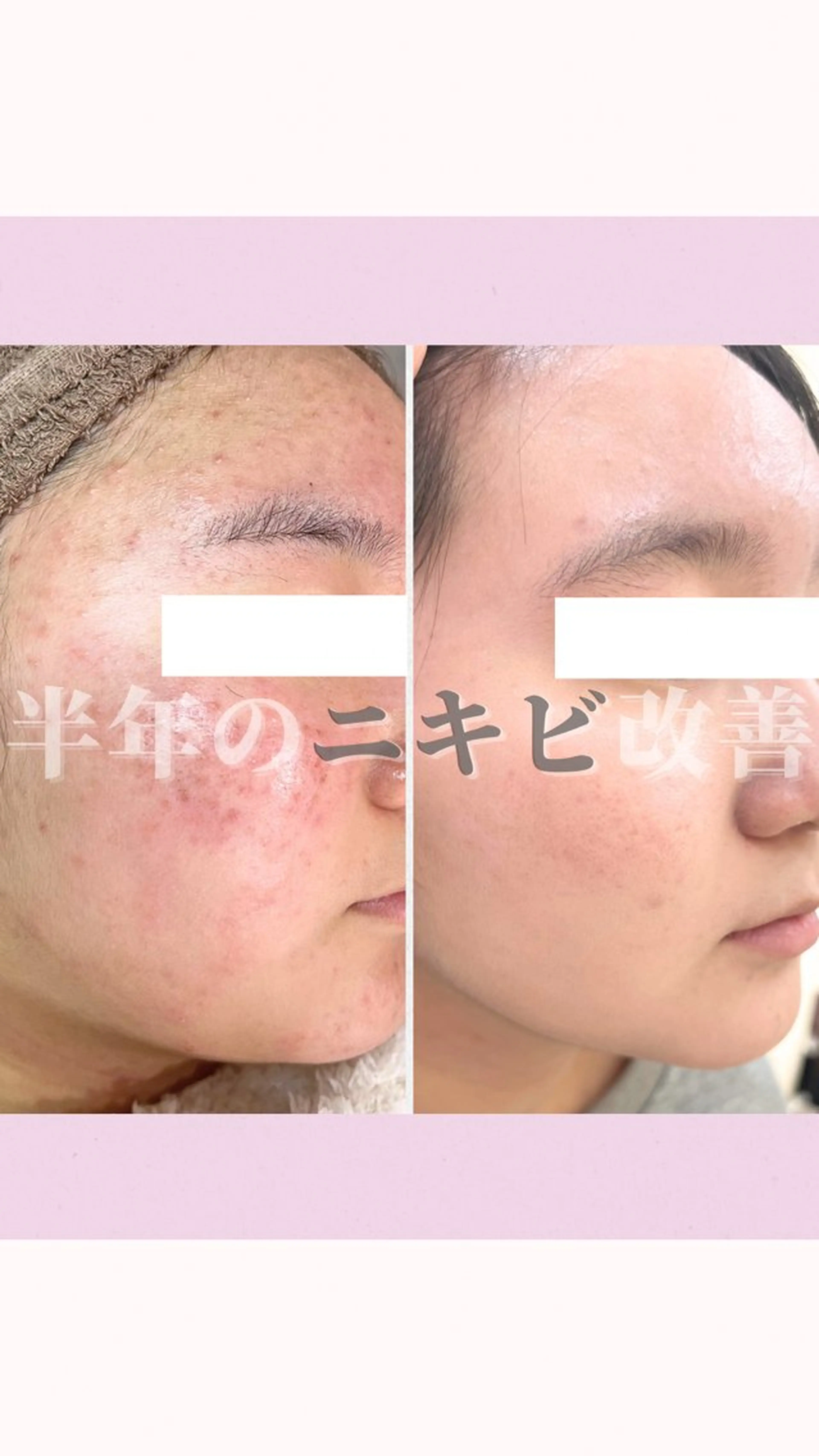 Muqu. 毛穴サロンのエステ・リラクイメージ