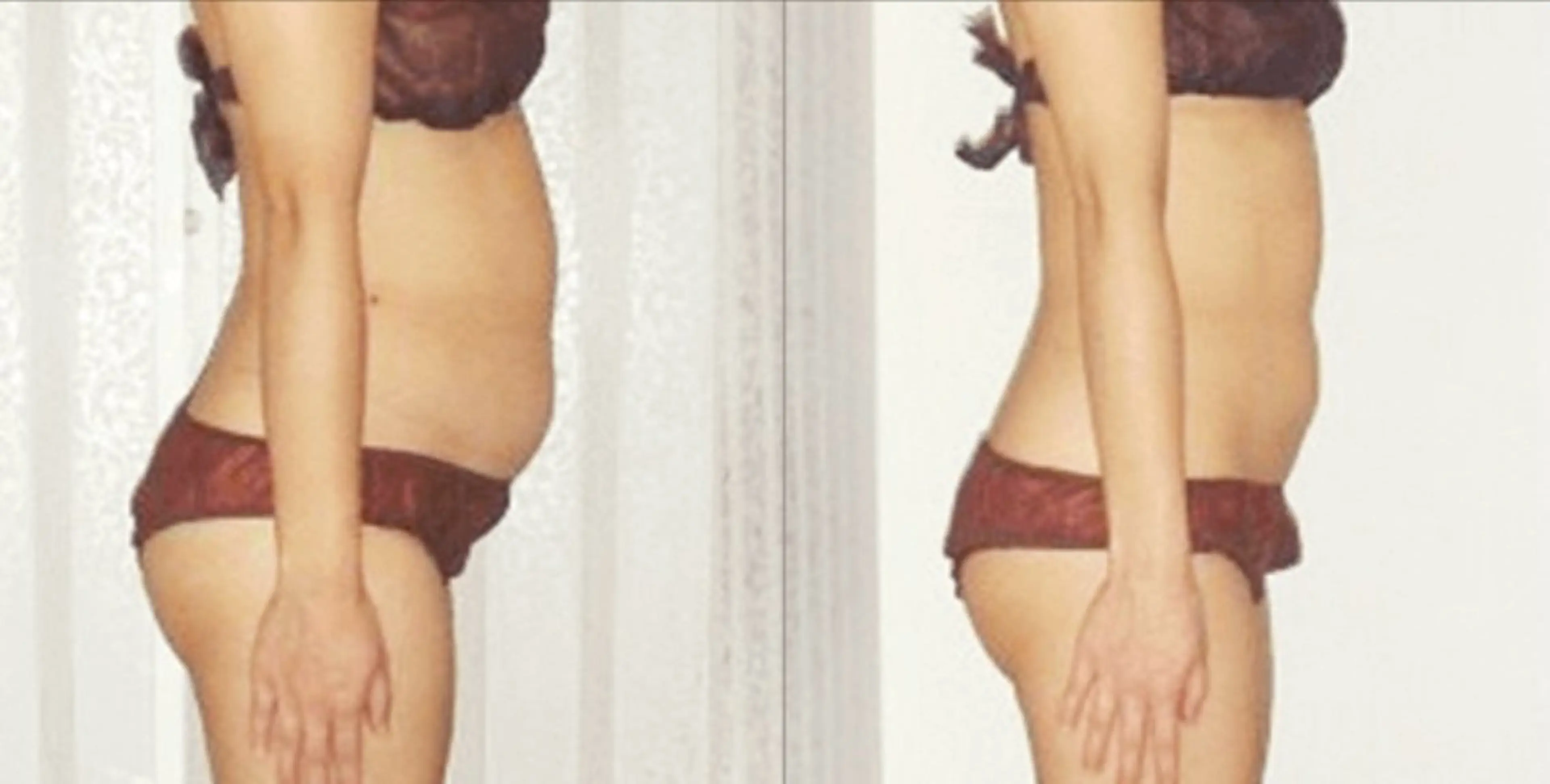 【4月限定✨】マグニート痩身　無料体験の写真