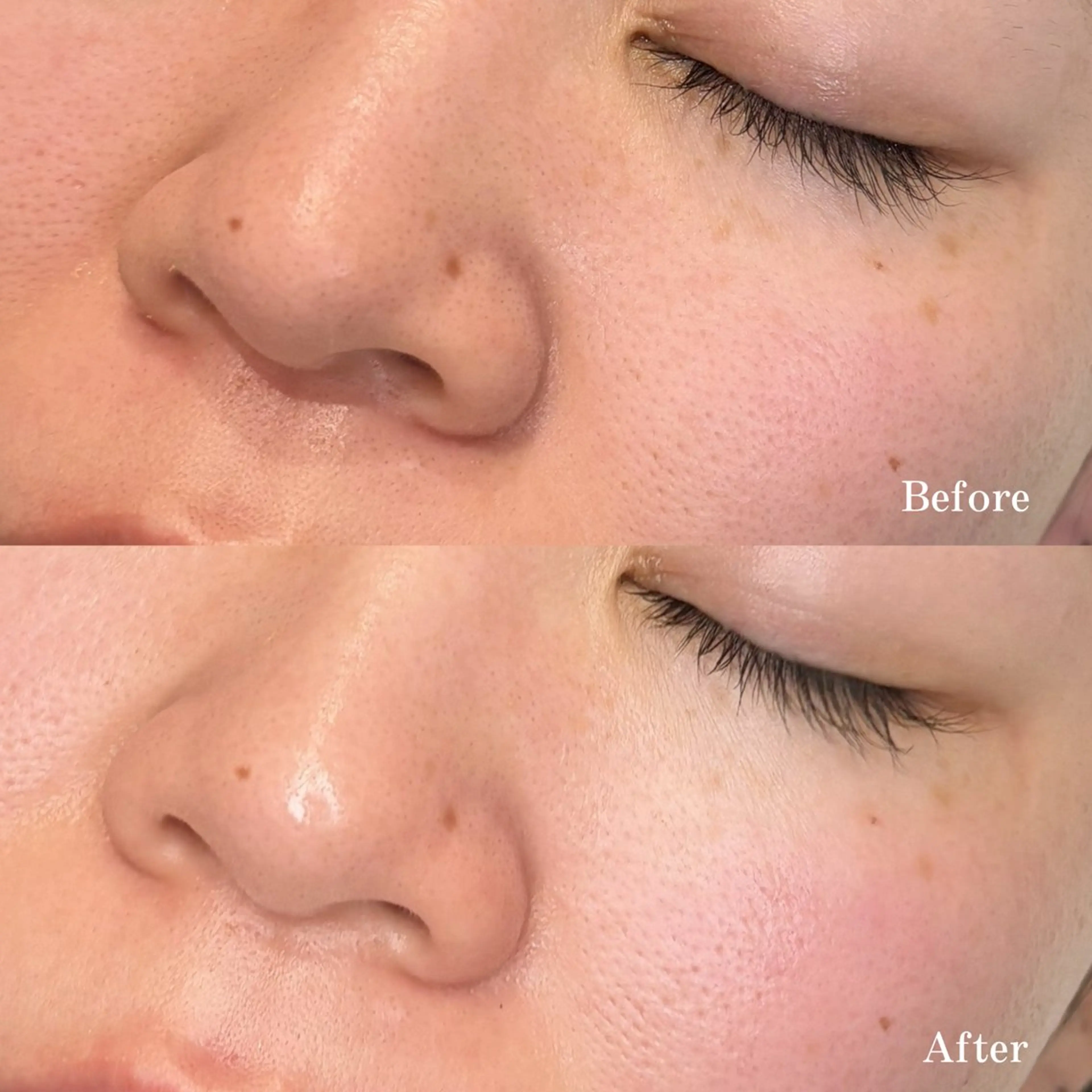 眉ワックス➕全顔ワックス(ホームケアパック付き)の写真