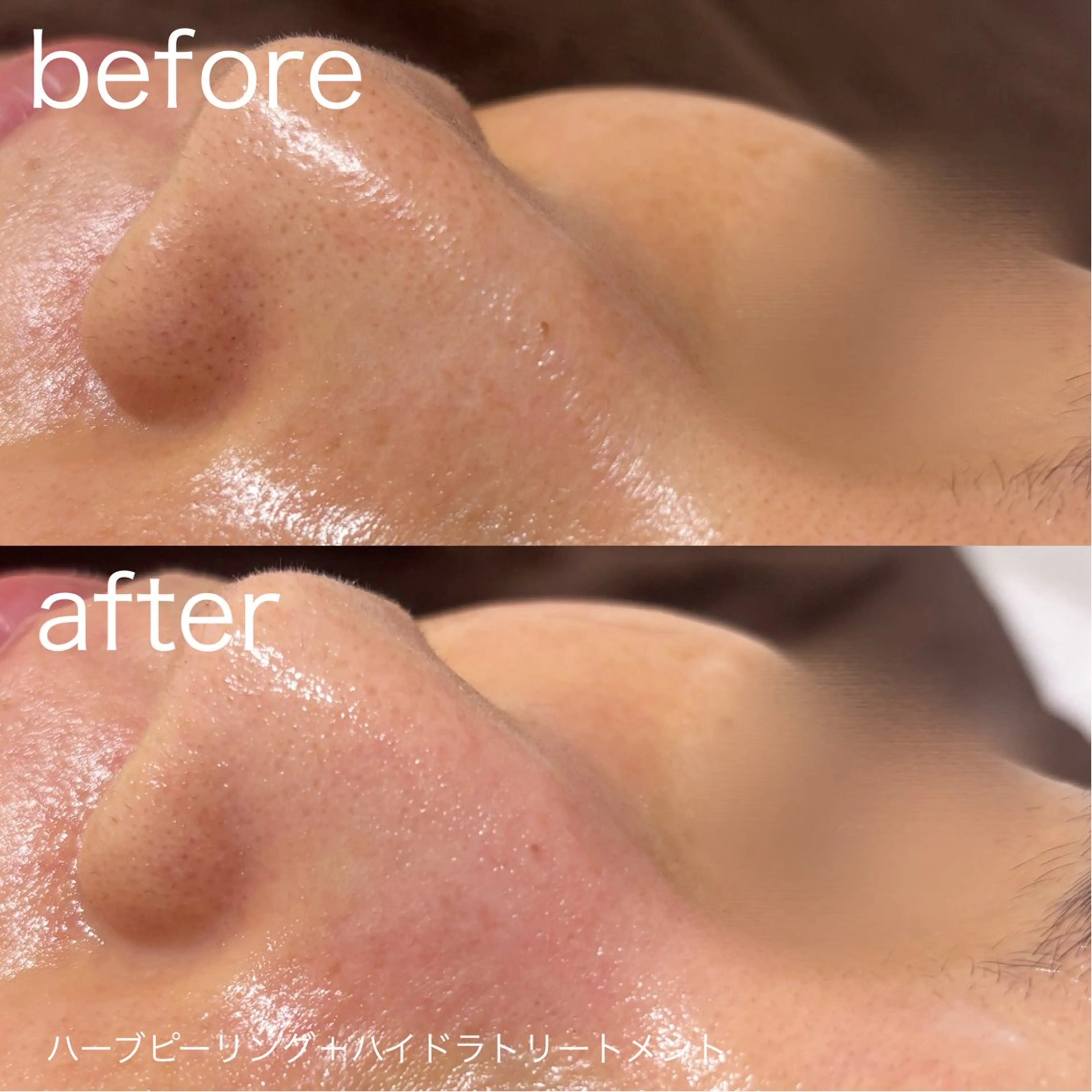 脱毛 lulularico Yuのエステ・リラクイメージ