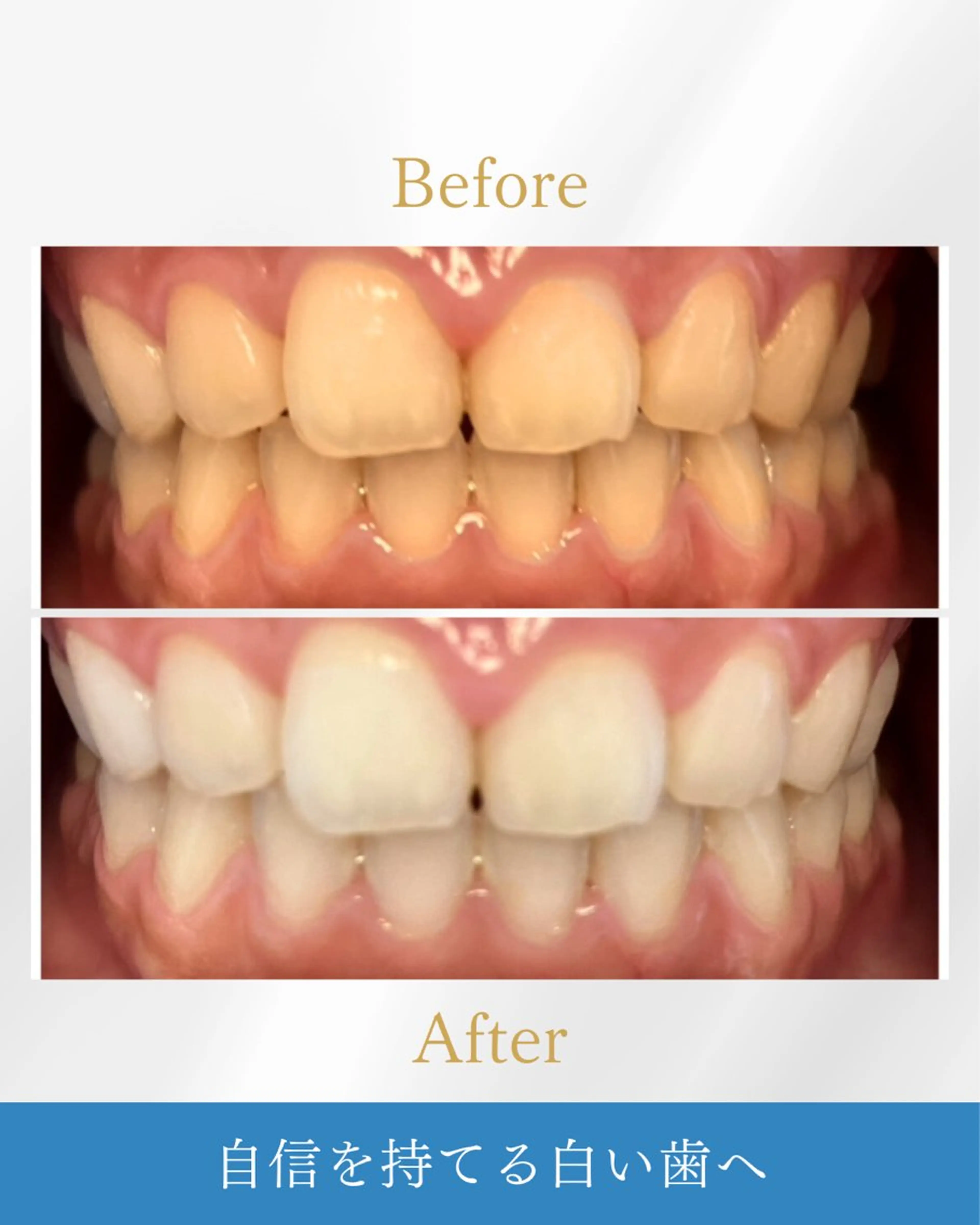 NAホワイトニング 溝の口店のエステ・リラクイメージ