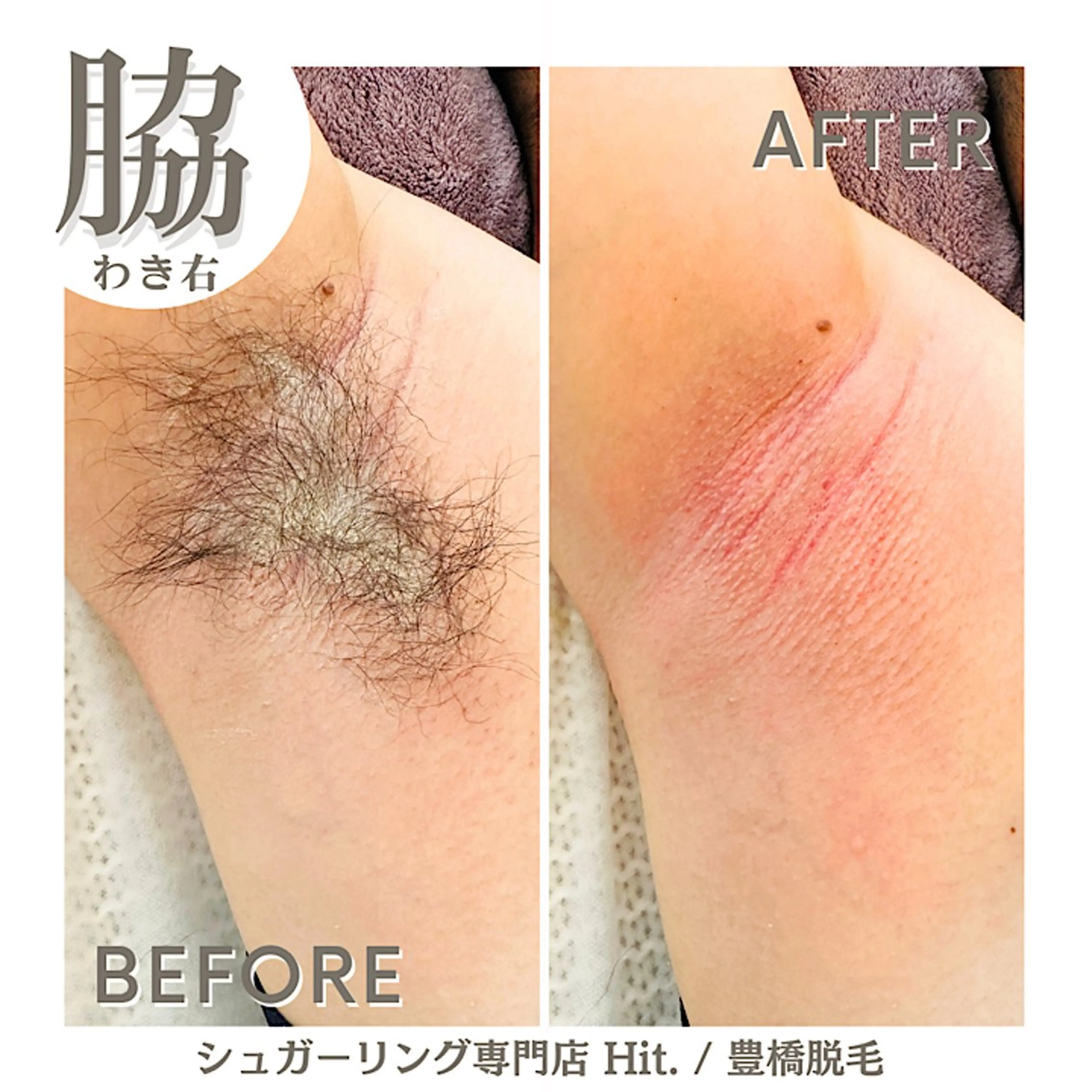 Hitomi シュガーリング豊橋のその他イメージ