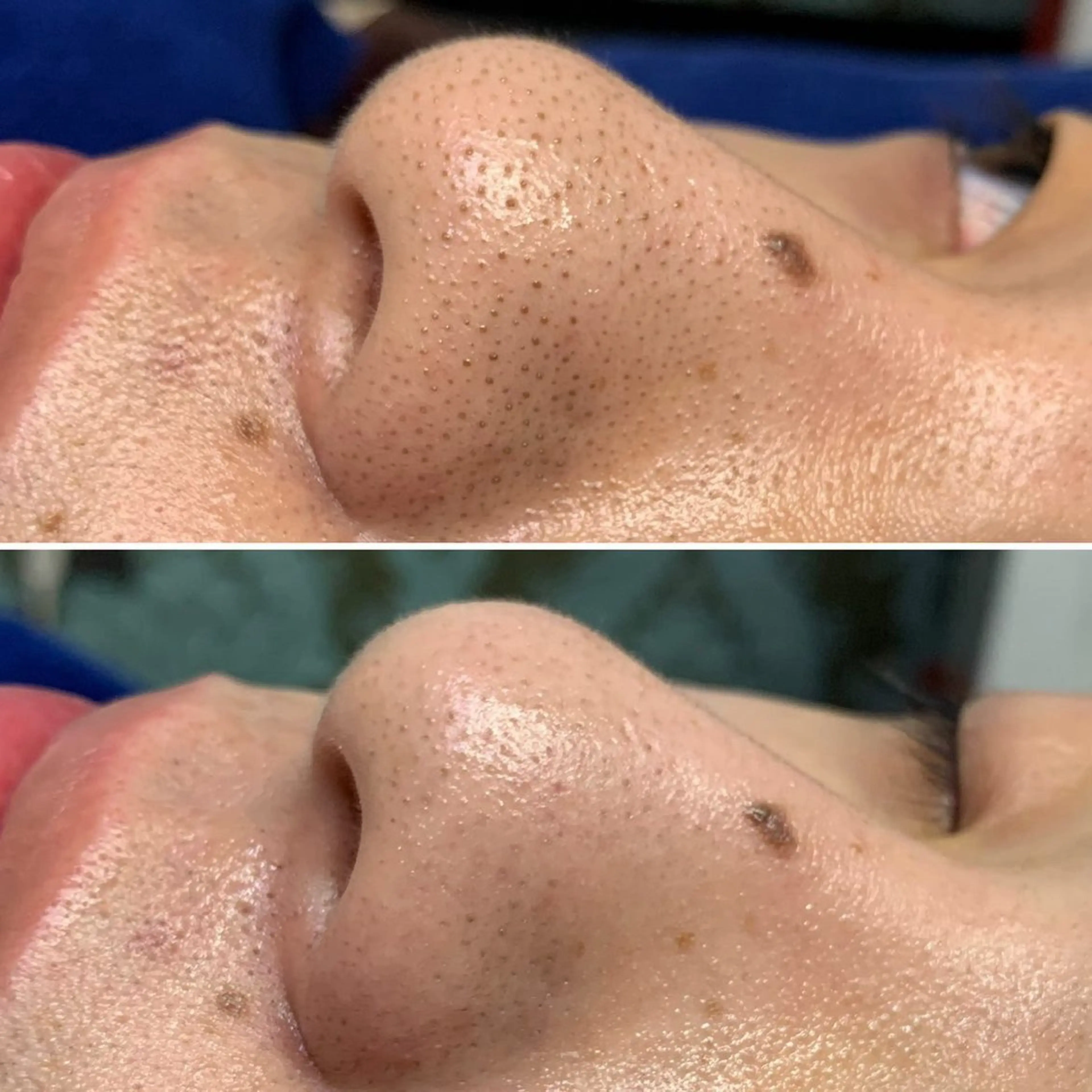 aroma  YURARI所属・韓国艶美人// 毛穴ケア🌹のエステ・リラクイメージ