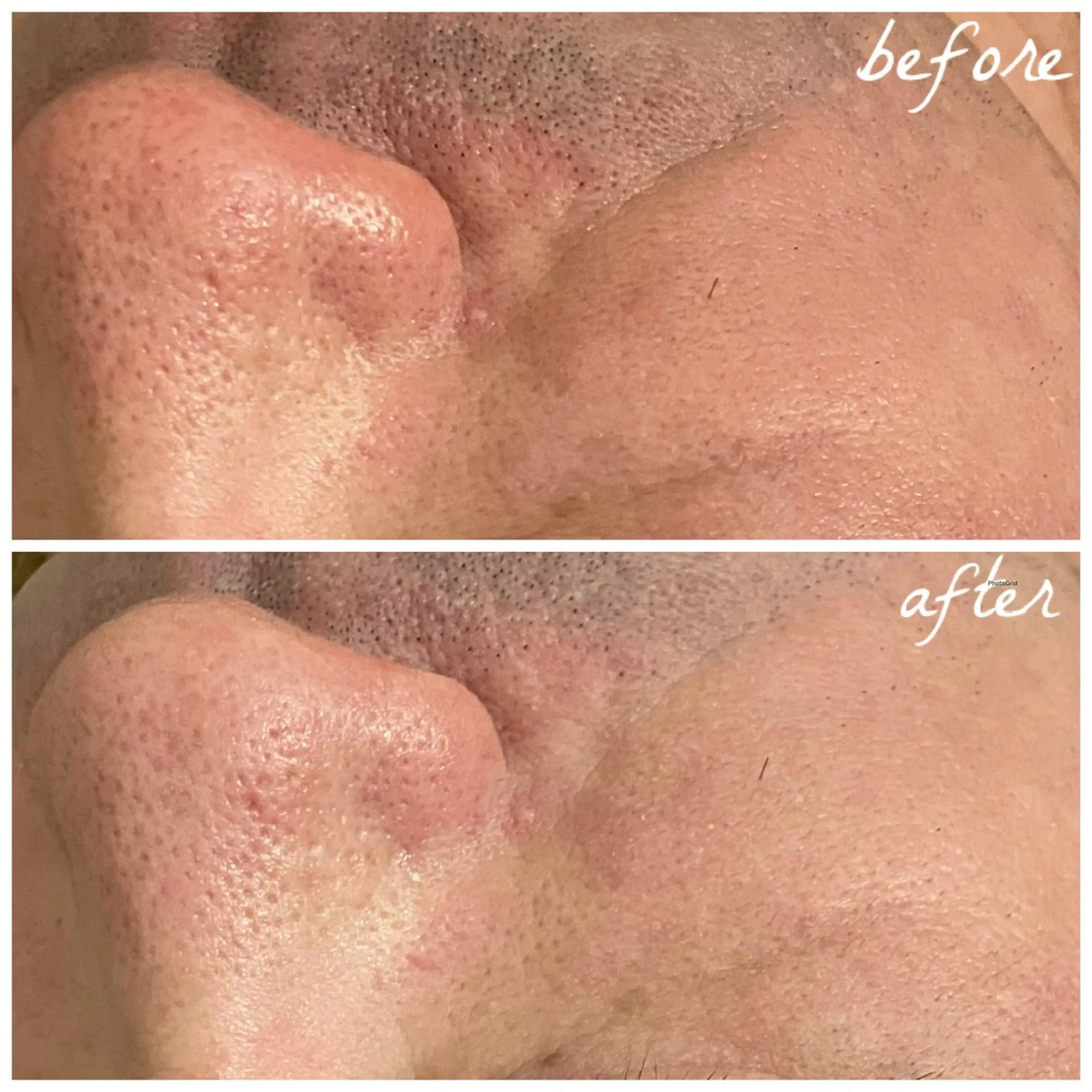 メンズ エステ メナード岐阜市茜部 杉浦のエステ・リラクイメージ