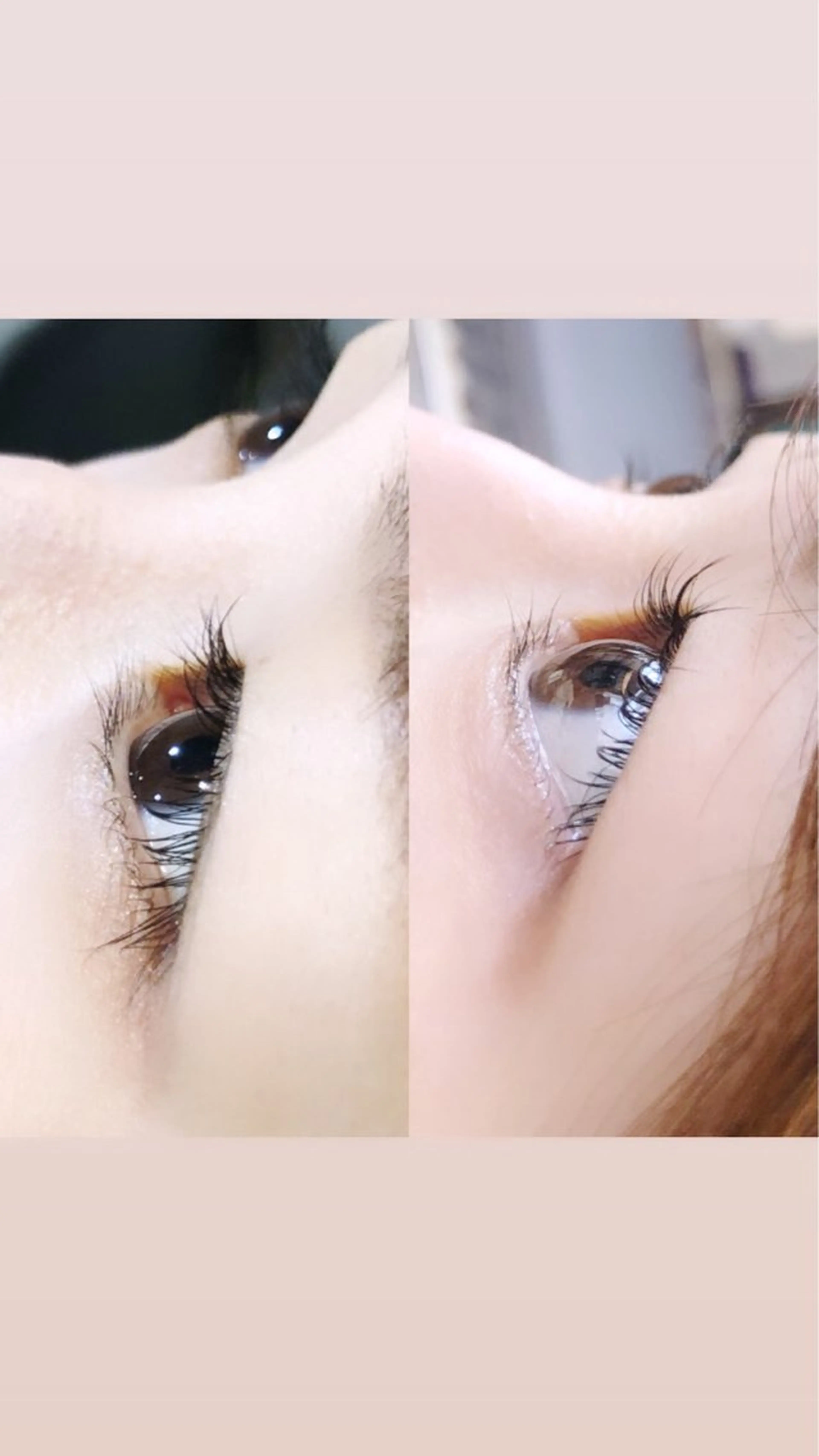 マツエク・マツパ 一重×まつ毛パーマ 💛🌼こんどう ひなた🐥⸒のマツエク・マツパデザイン