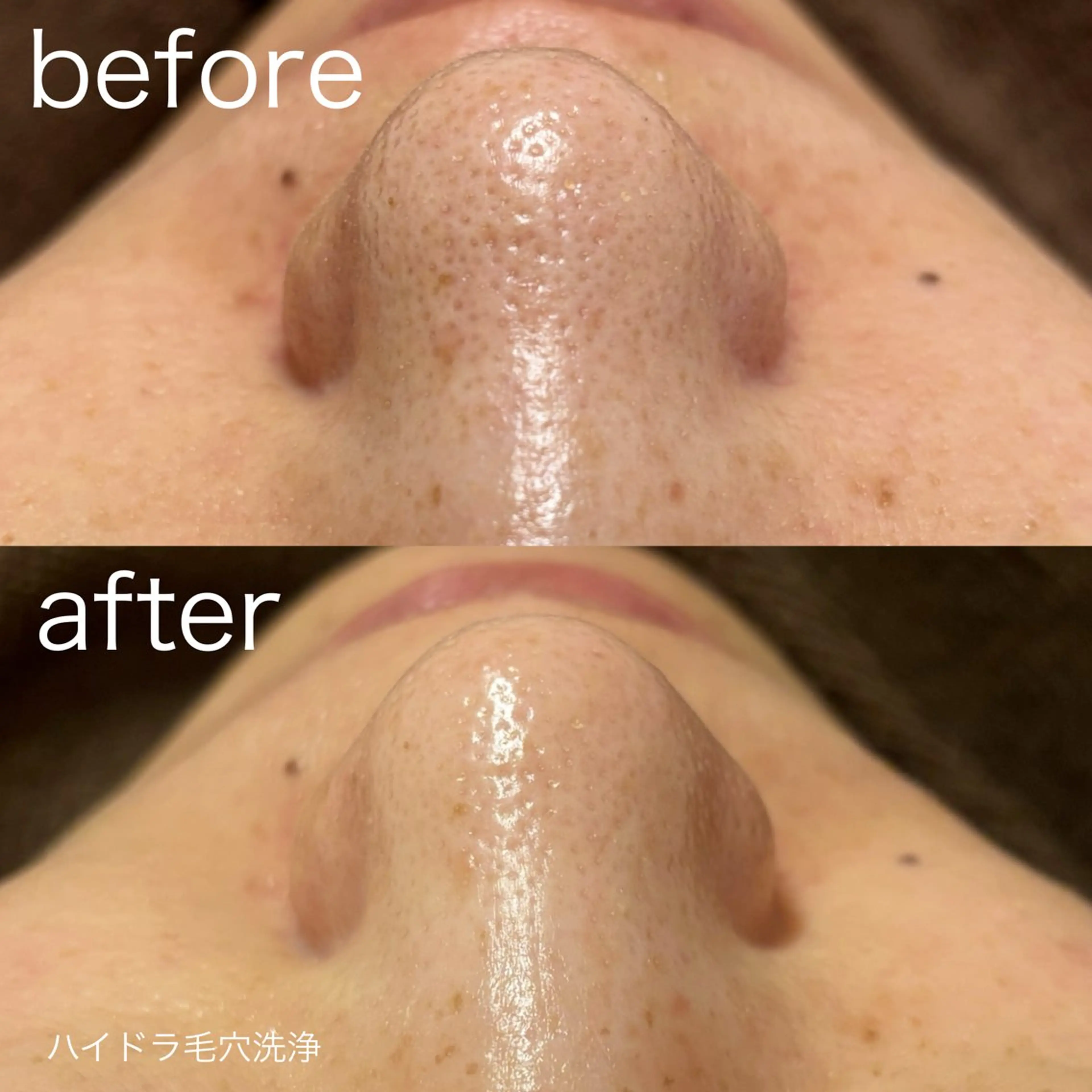 脱毛 lulularico Yuのエステ・リラクイメージ