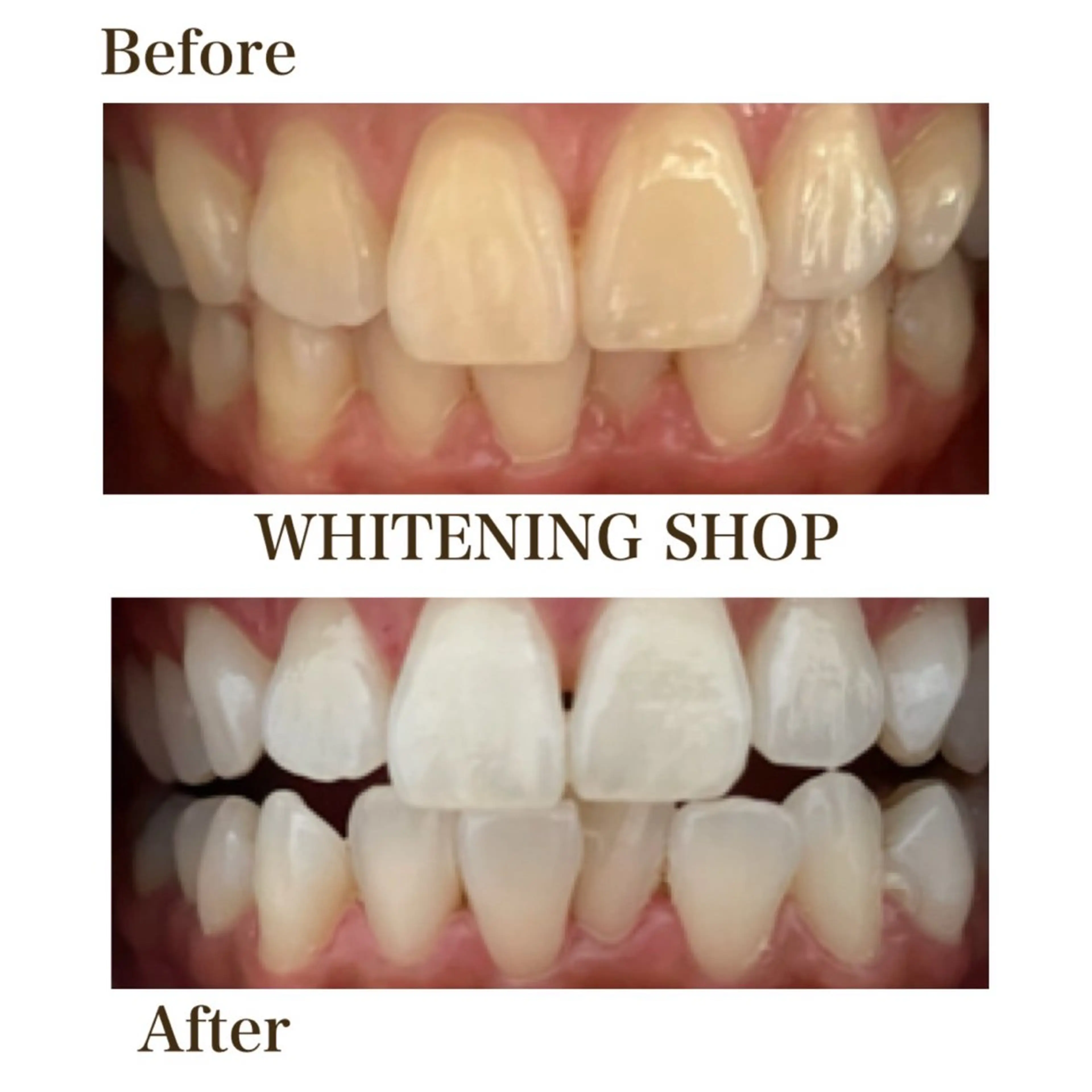 メンズ エステ リラク ホワイトニング ショップ川越店のエステ・リラクイメージ