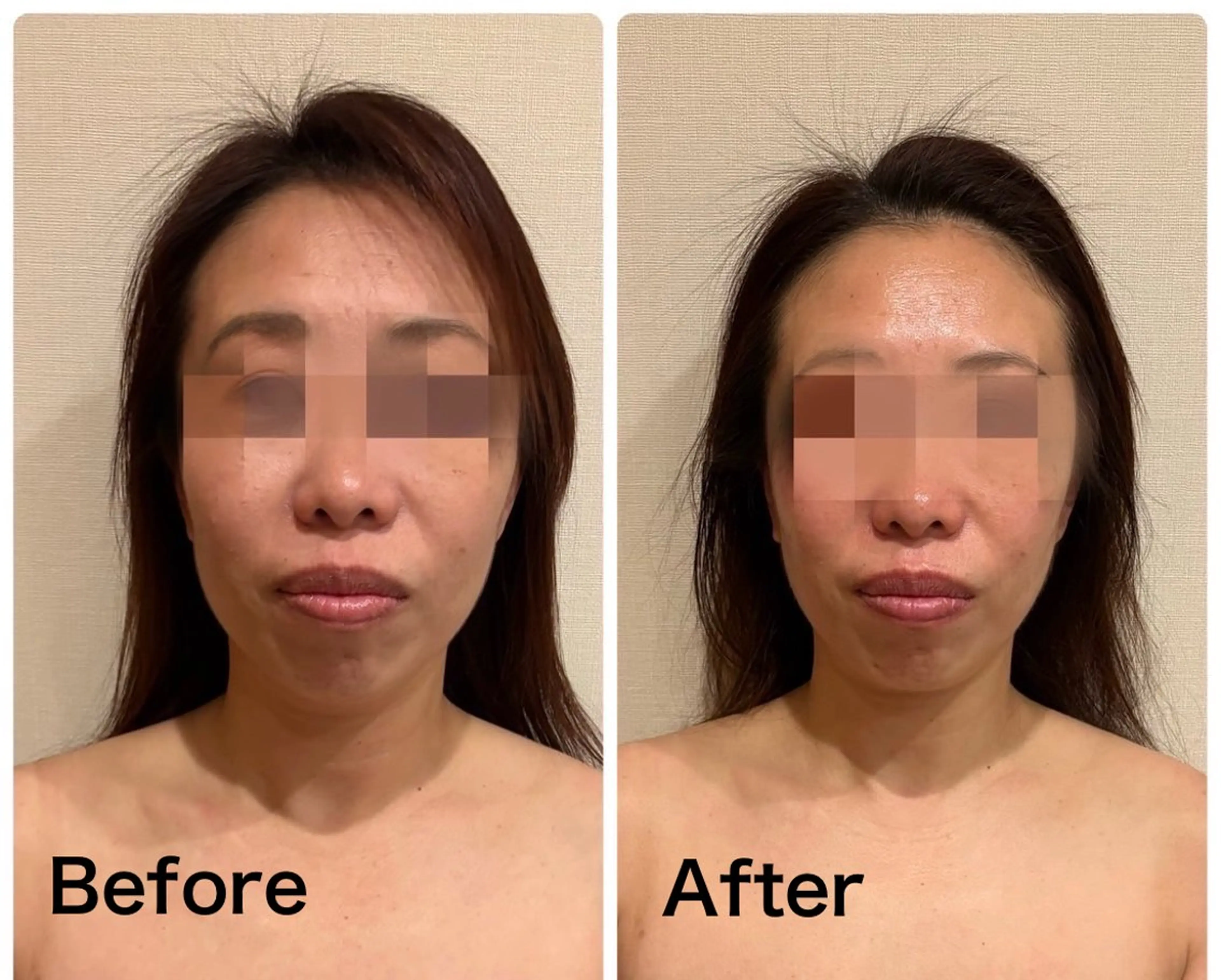 エステ 美肌脱毛サロン muroのエステ・リラクイメージ