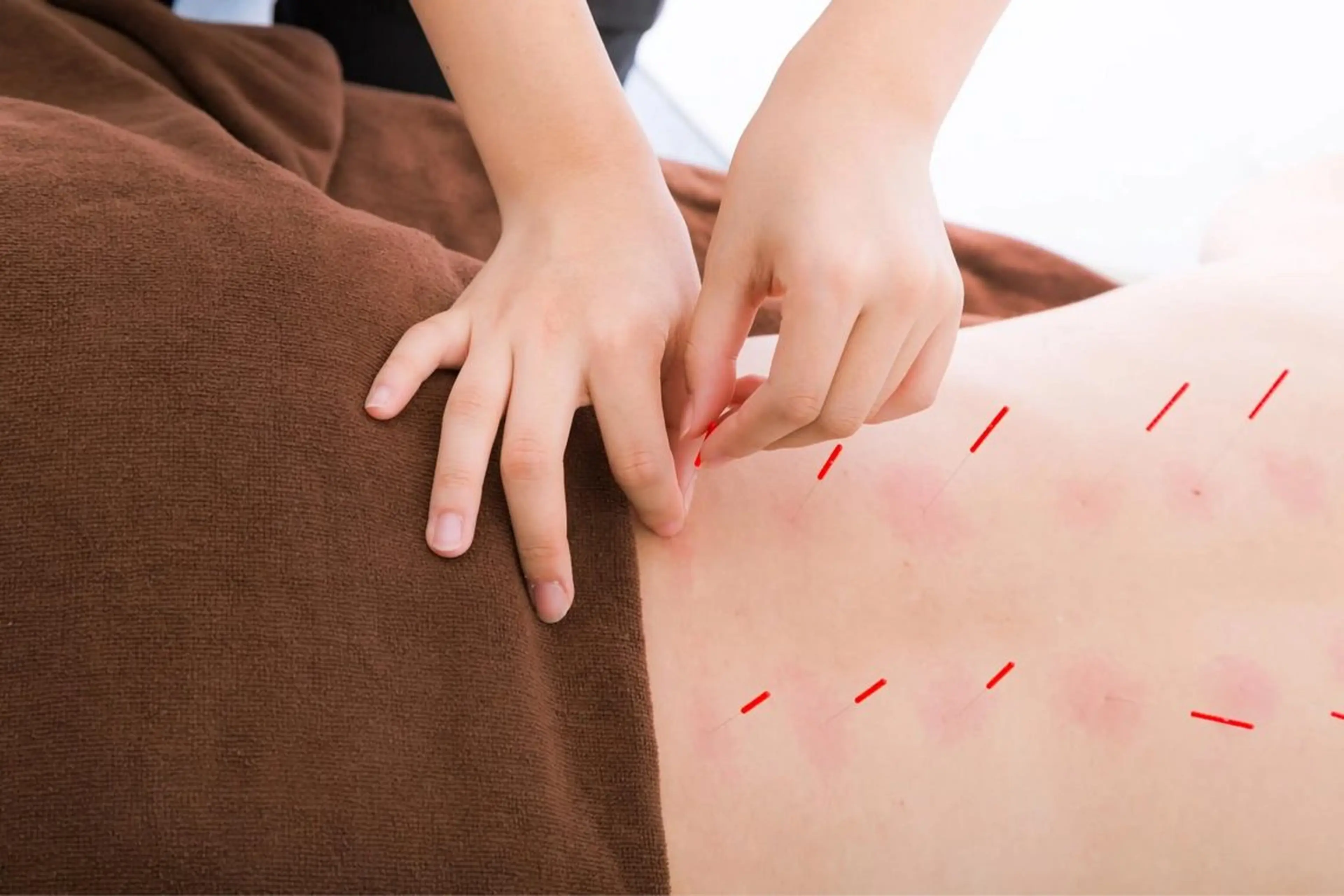 【整体×鍼灸施術】深層の根本改善(カウンセリング込60分)の写真