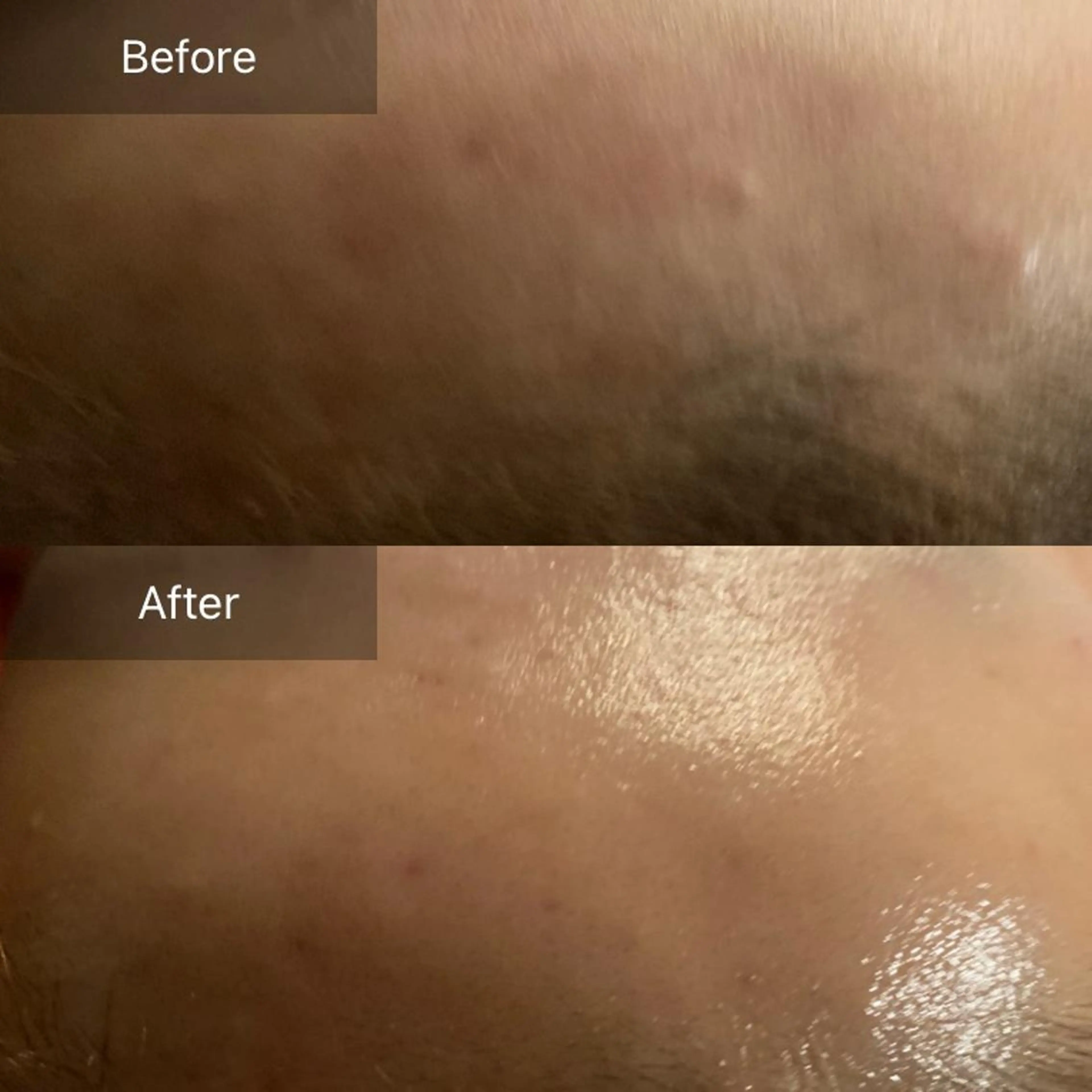 毛穴から始める肌メン テマンダリンオレンジのエステ・リラクイメージ