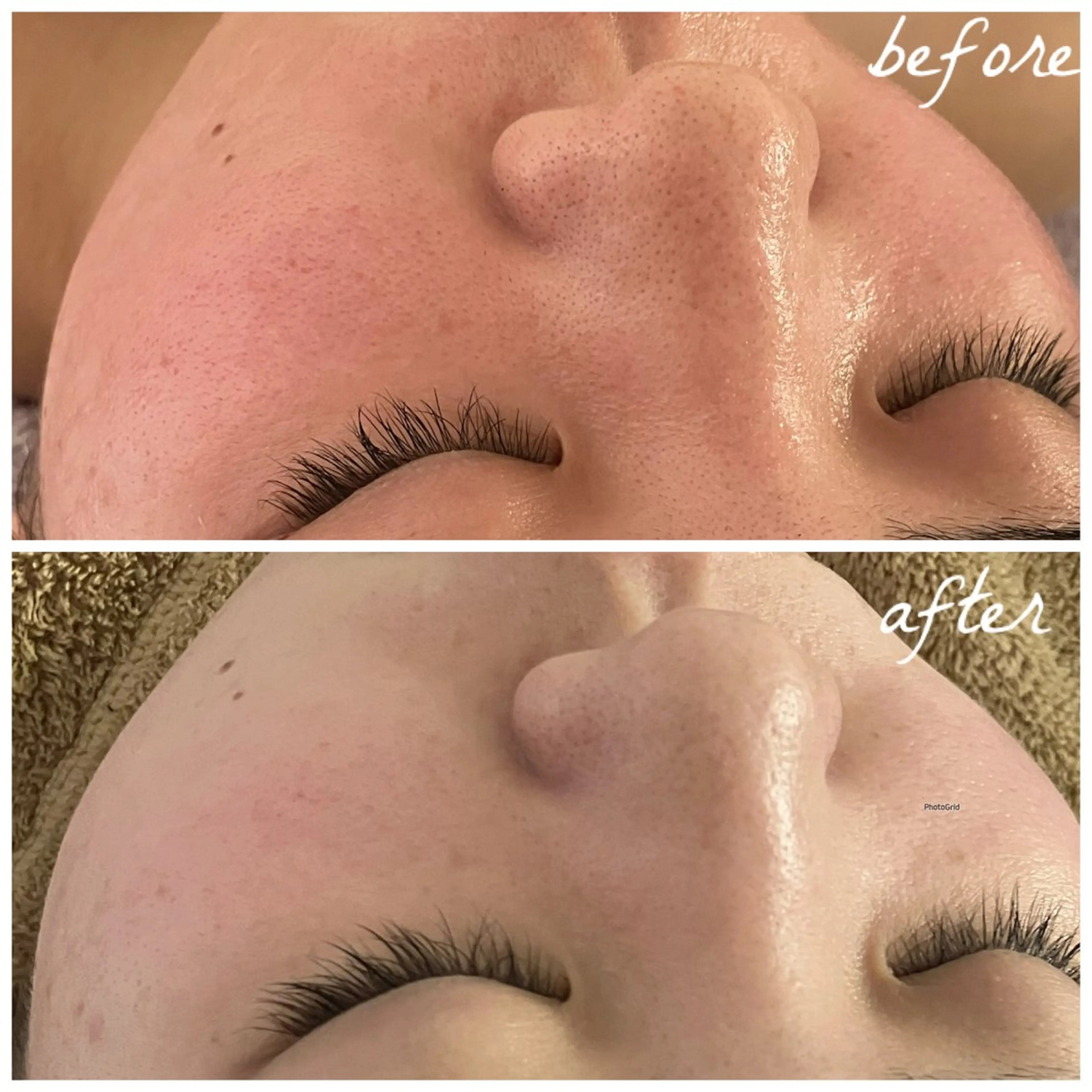 メンズ エステ メナード岐阜市茜部 杉浦のエステ・リラクイメージ