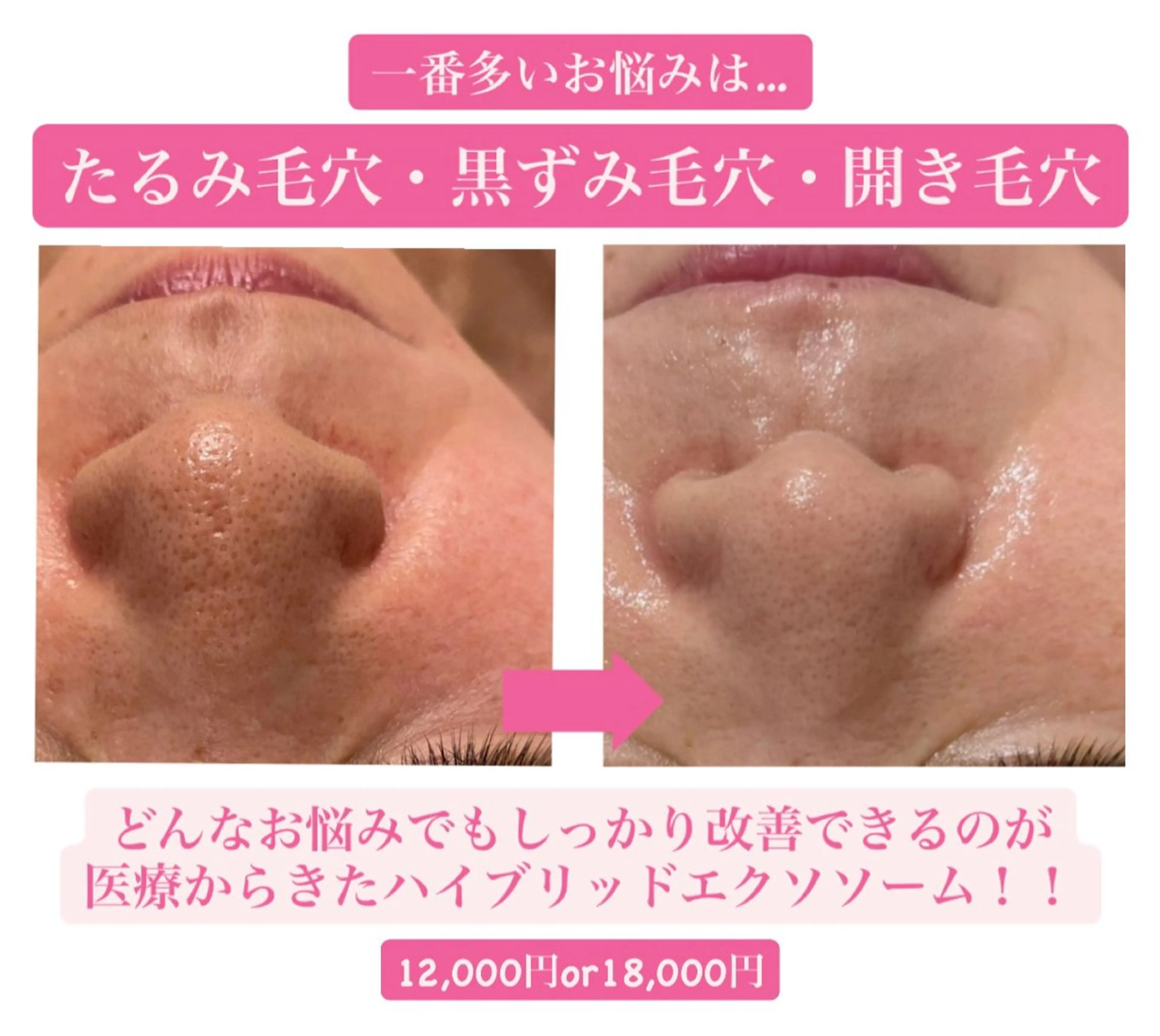 【肌質改善・肌育】医療からきた本格エステの写真