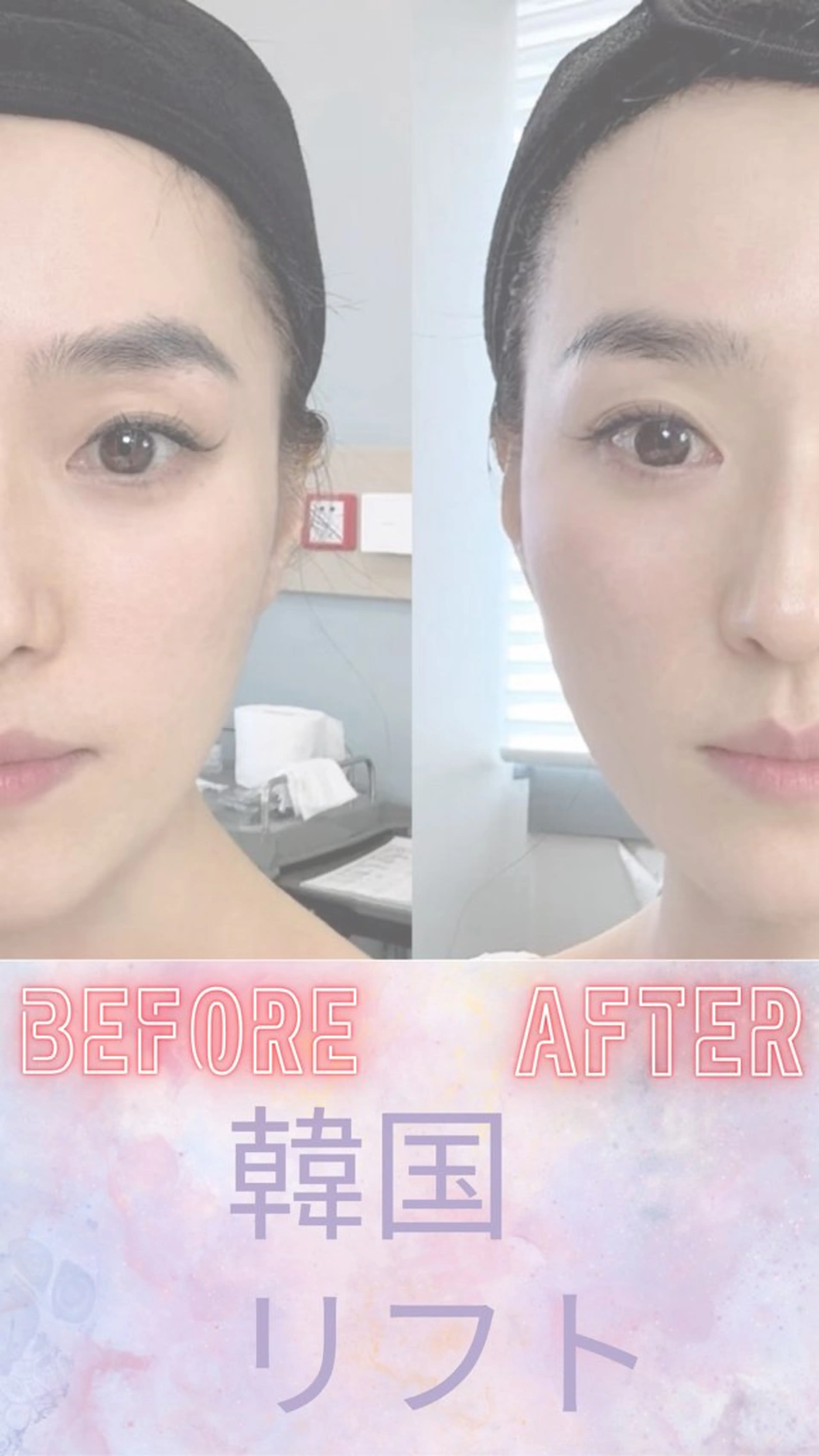 ショート エステ 愛維美水光美肌専門店 メンズレディースokのエステ・リラクイメージ