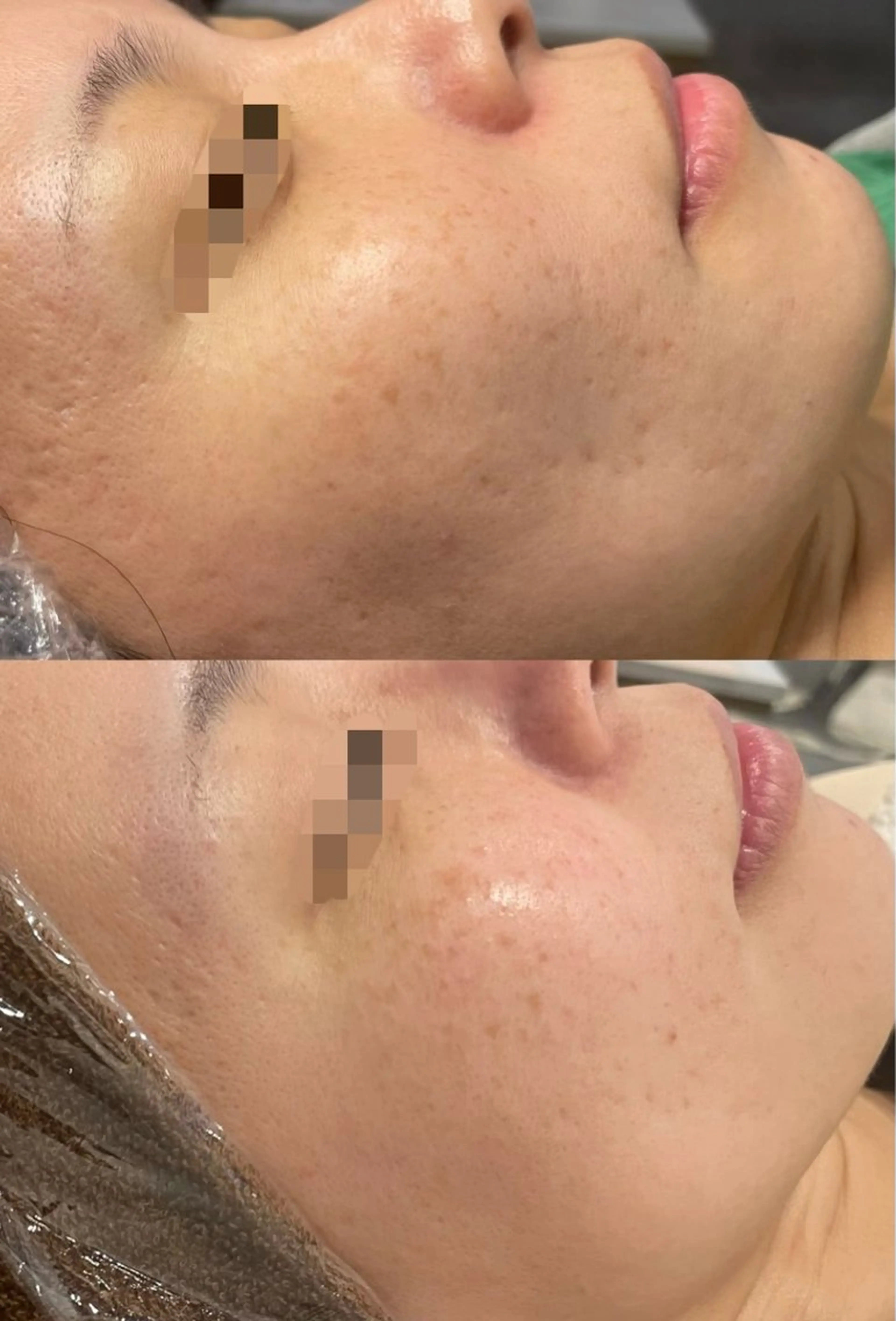 シミケア専門店モルセラ所属・シミケア専門店 モルセラのエステ・リラクイメージ