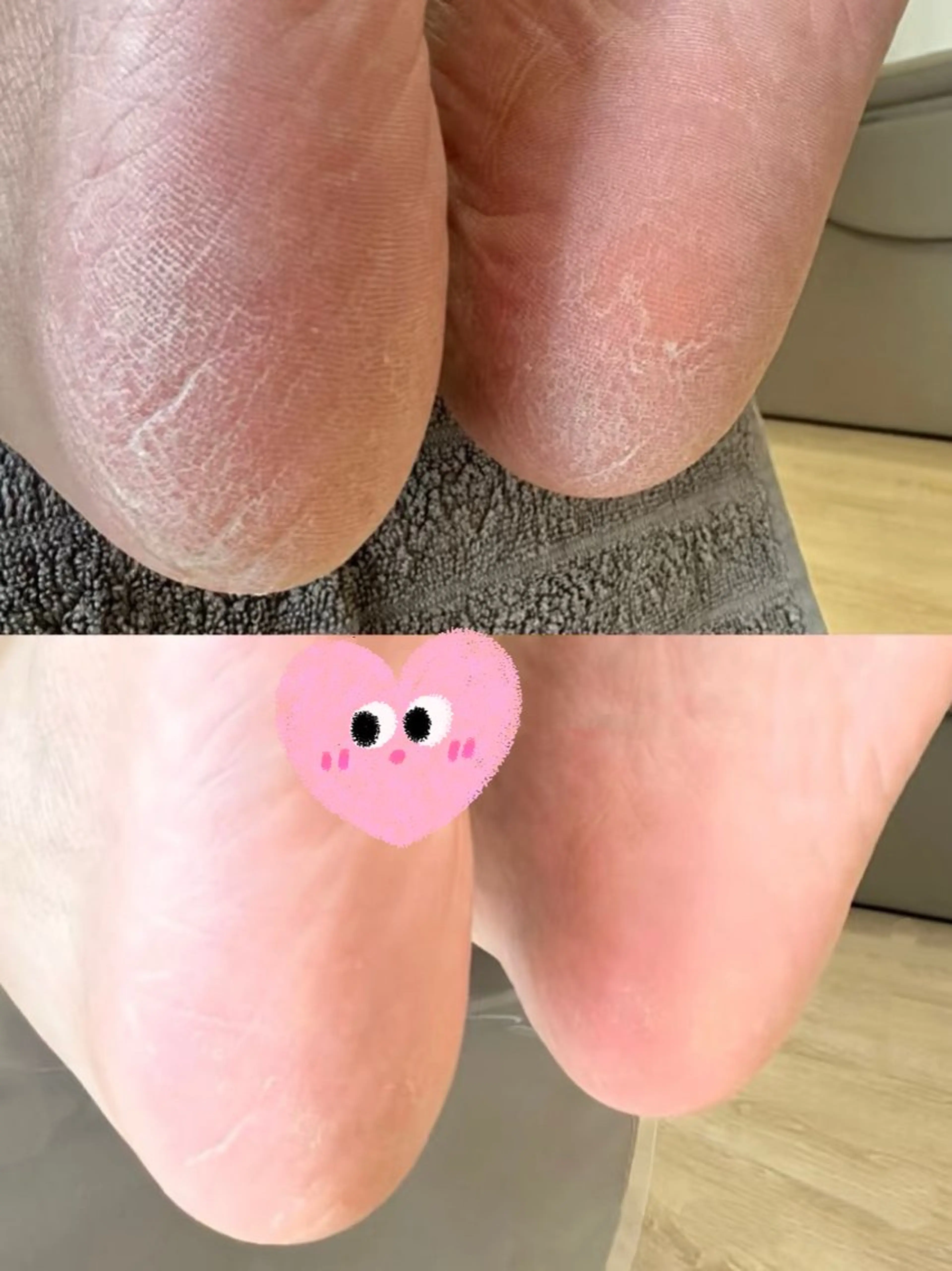 フットケアの写真