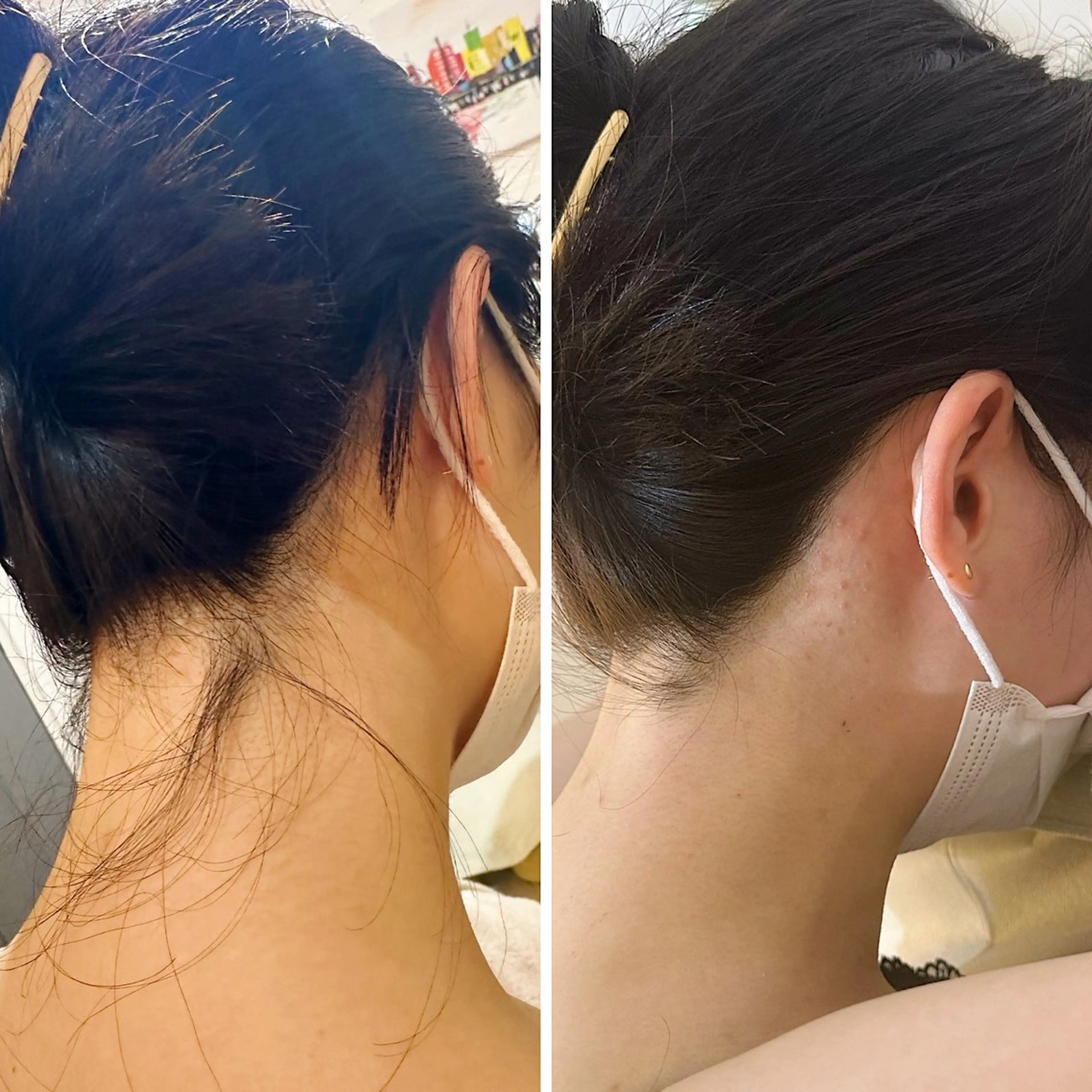 脱毛 うなじ脱毛/美肌脱毛 LABELのエステ・リラクイメージ