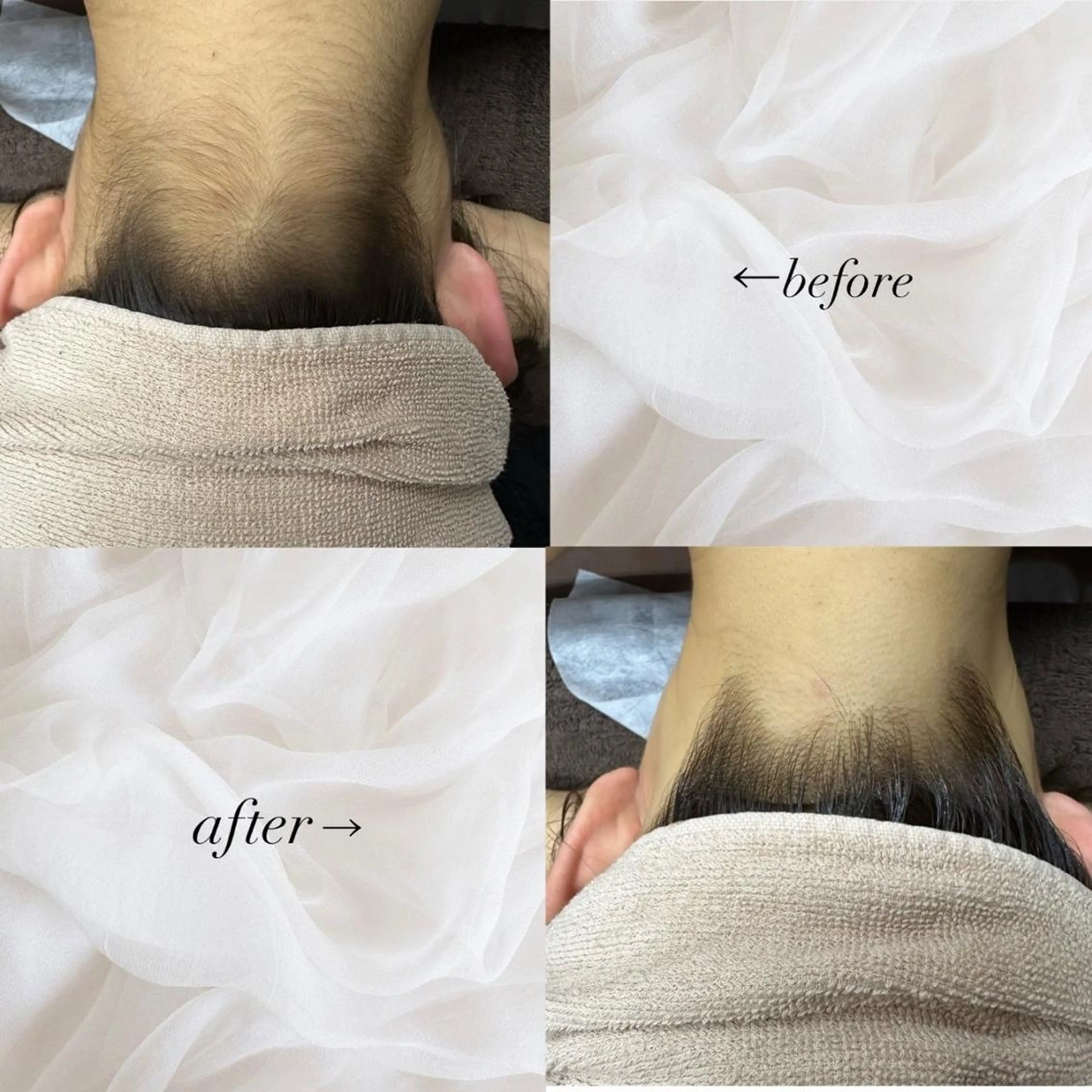 RinRin 豊田店のエステ・リラクイメージ