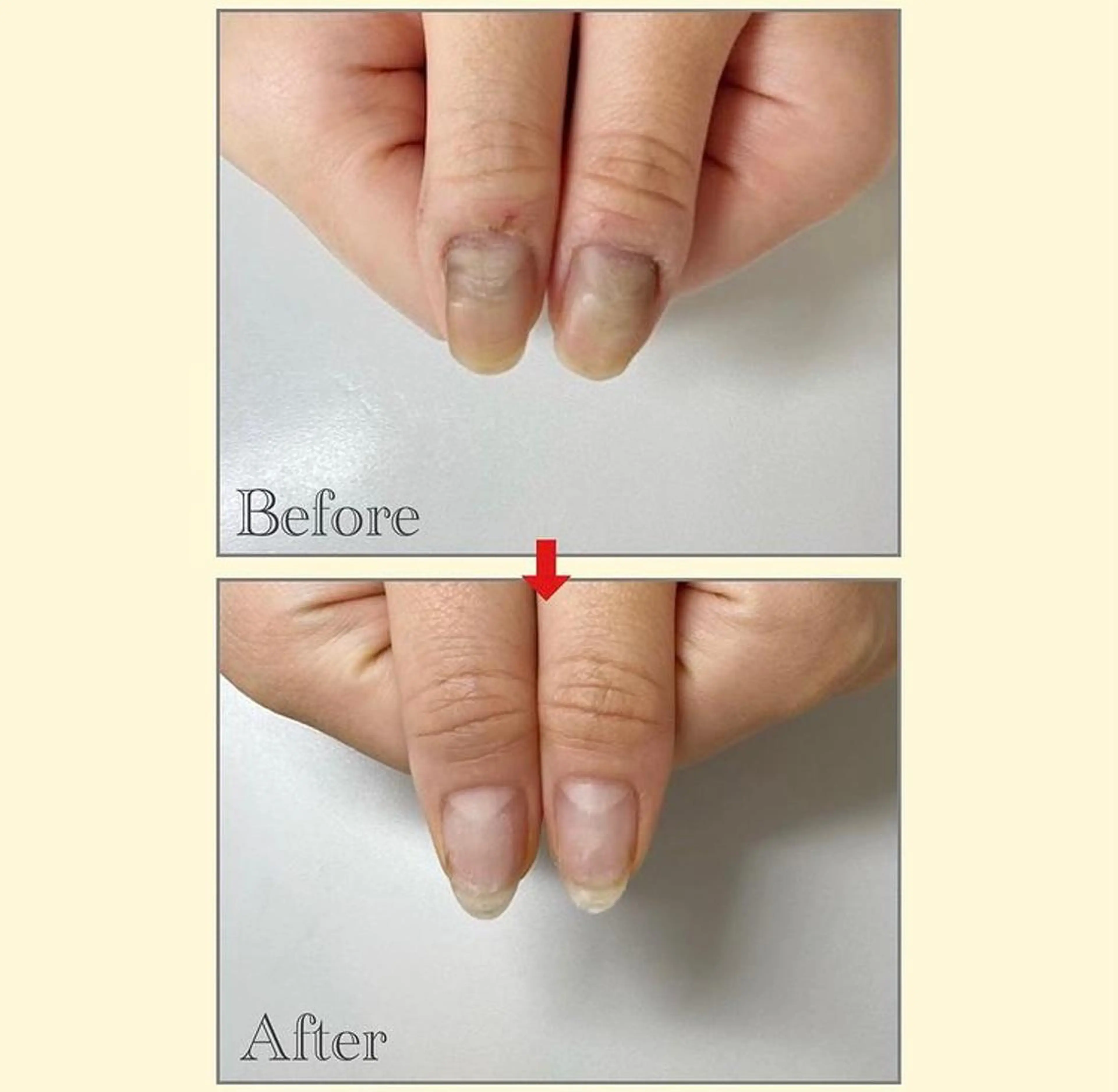 ネイル ネイルサロン アリュームのネイルデザイン