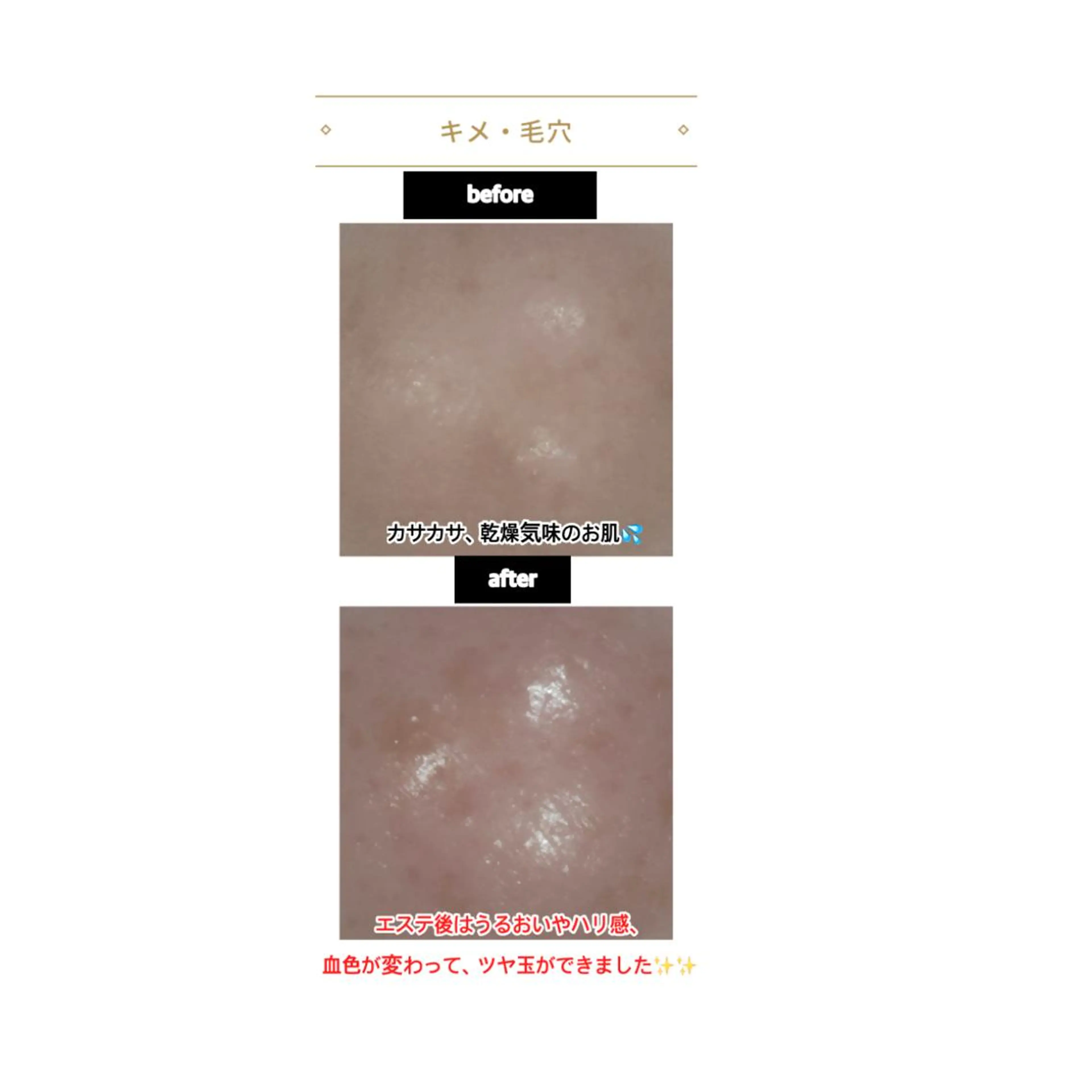 メナード　天神 やまさきのエステ・リラクイメージ