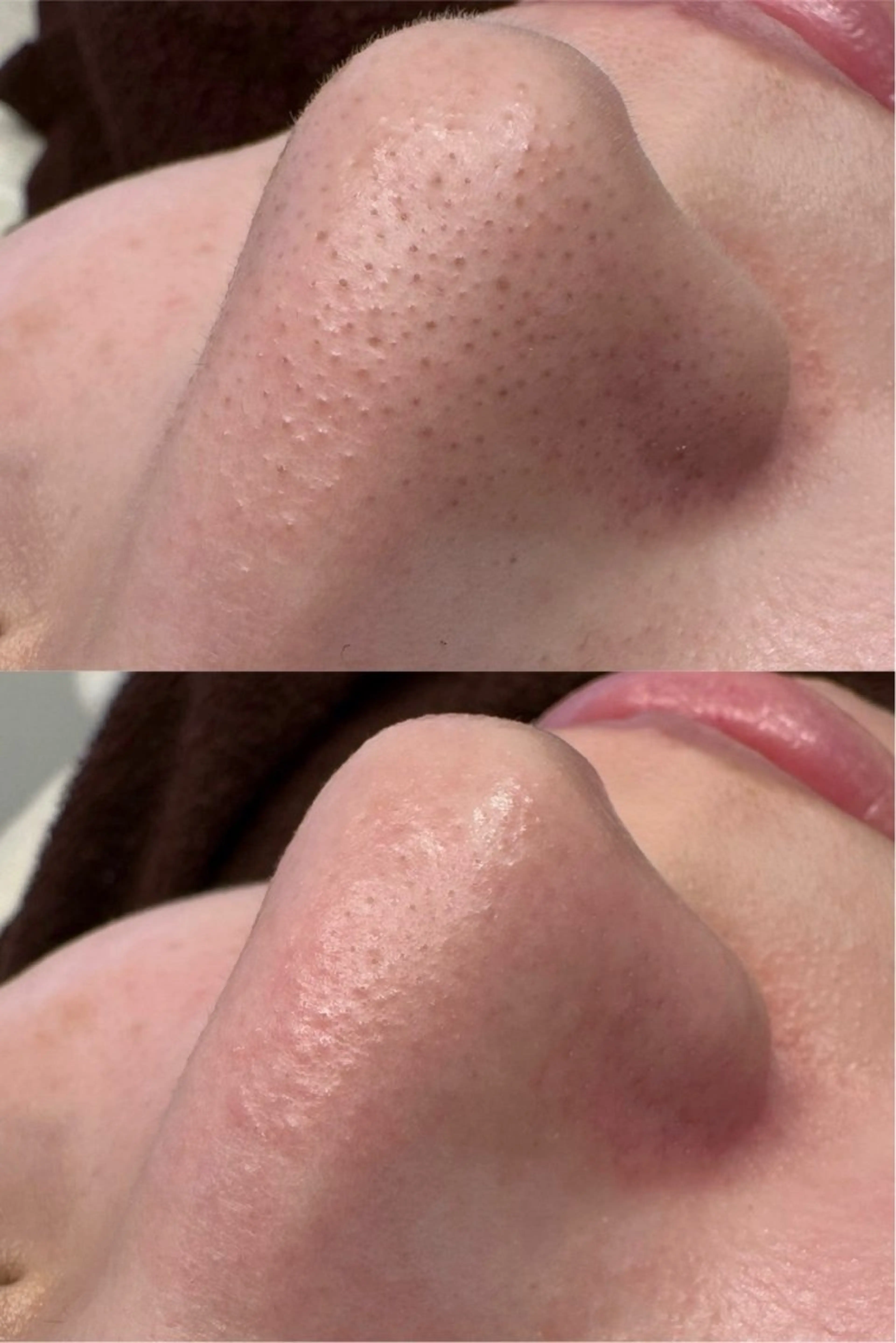 脱毛 岩田 里央のエステ・リラクイメージ