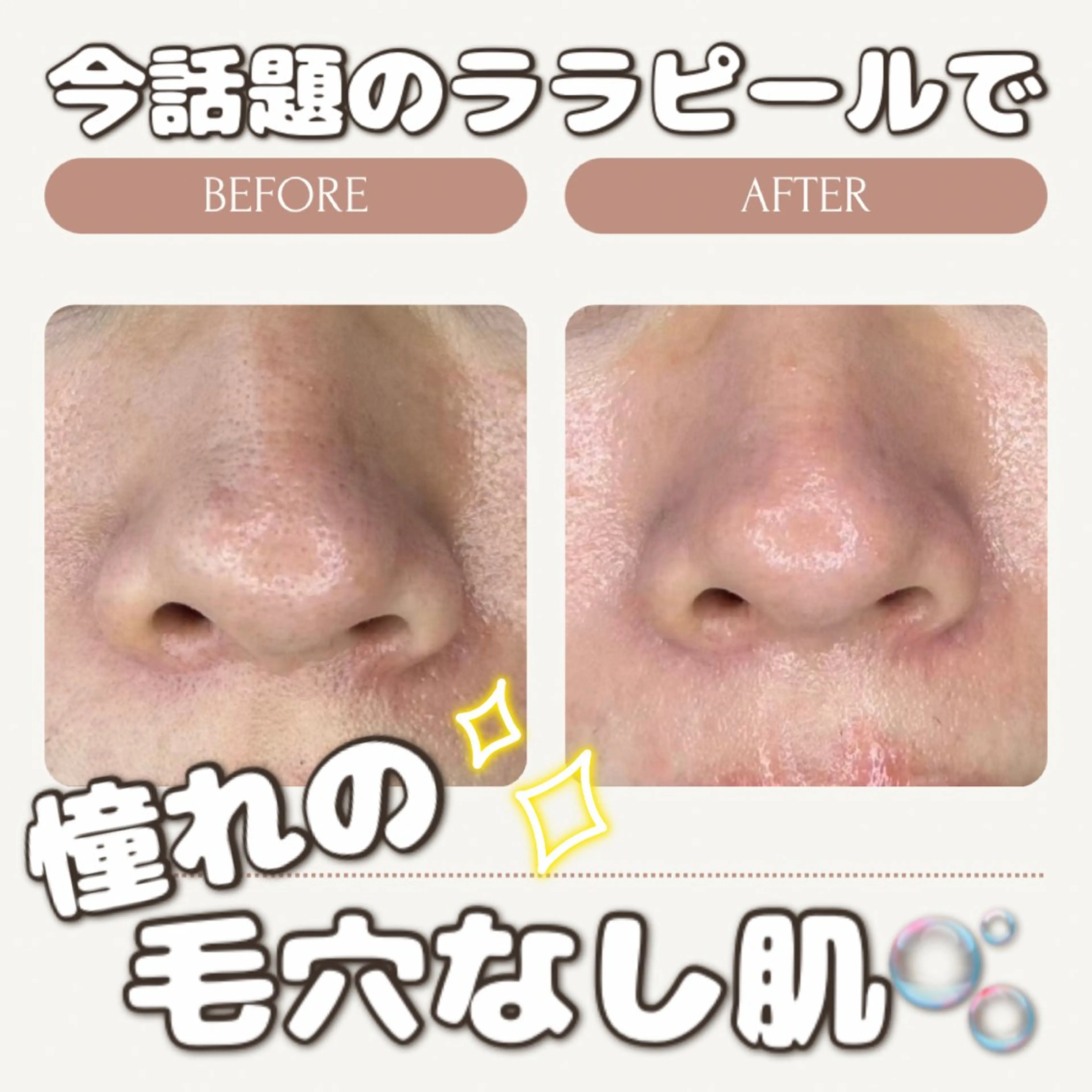 中目黒ハーブピーリン グ🌿ララピールのエステ・リラクイメージ