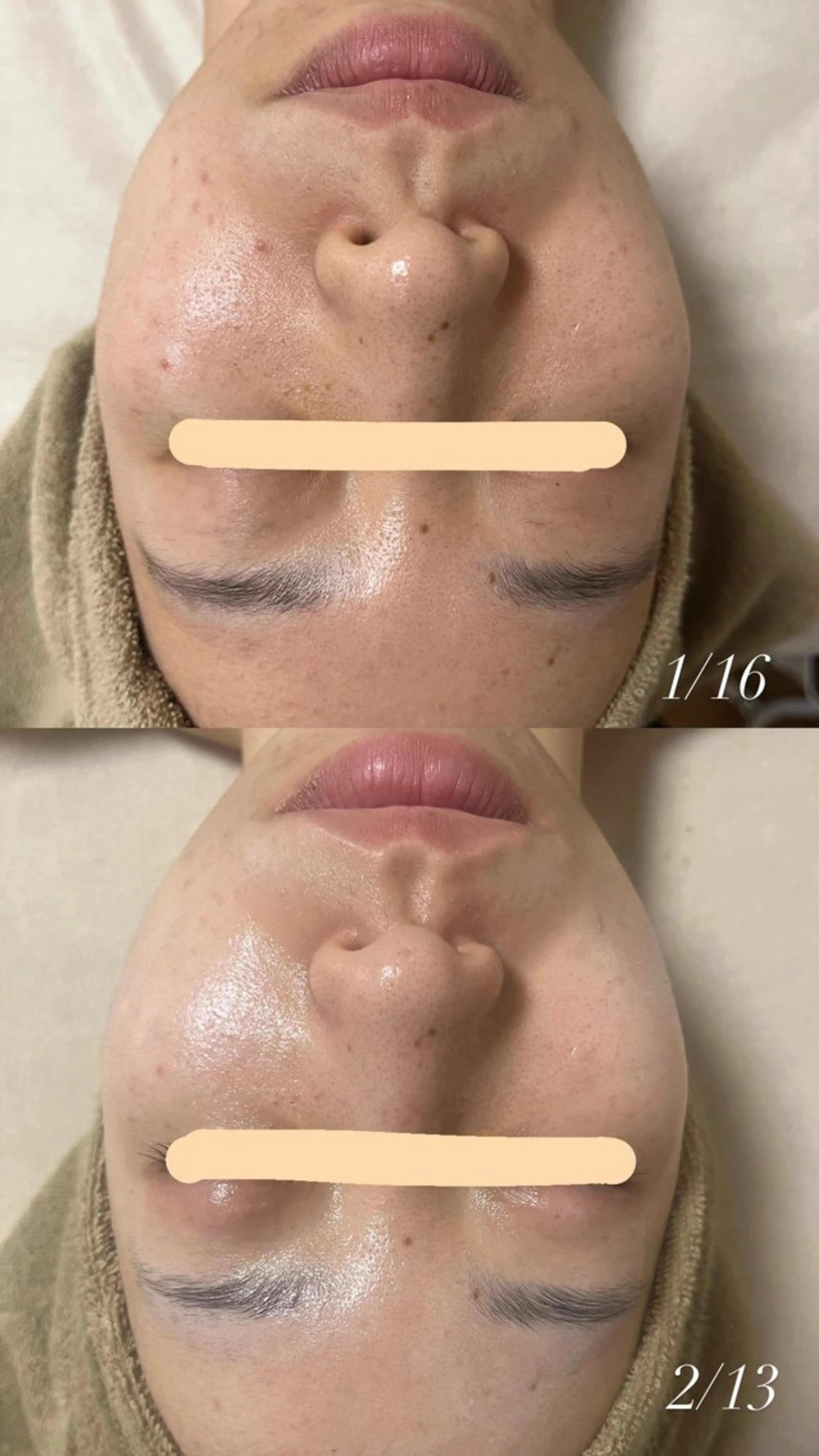 エステ 出口 玲菜のその他イメージ