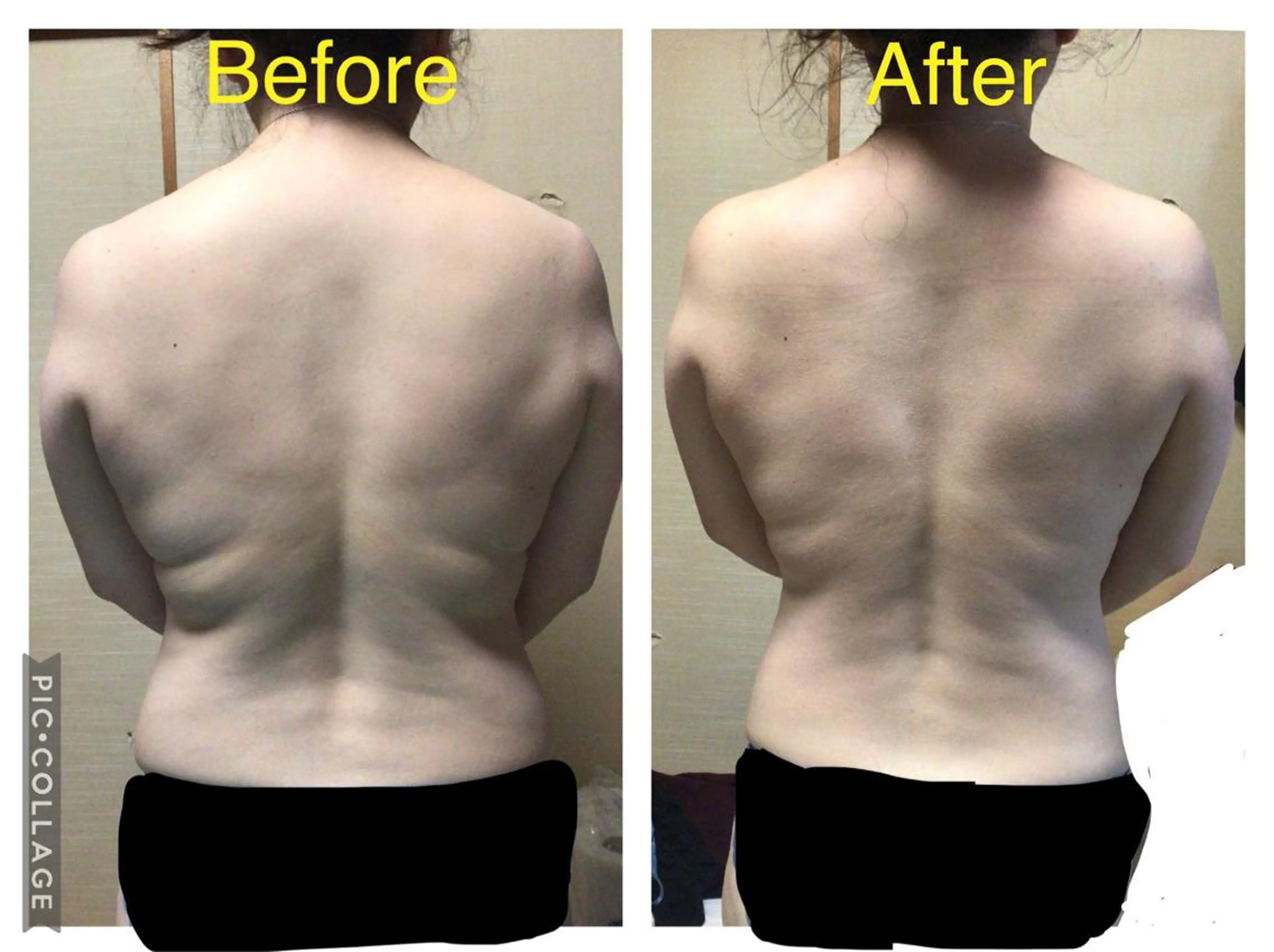 子宮矯正/腸揉み/ シュガーリング脱毛のエステ・リラクイメージ