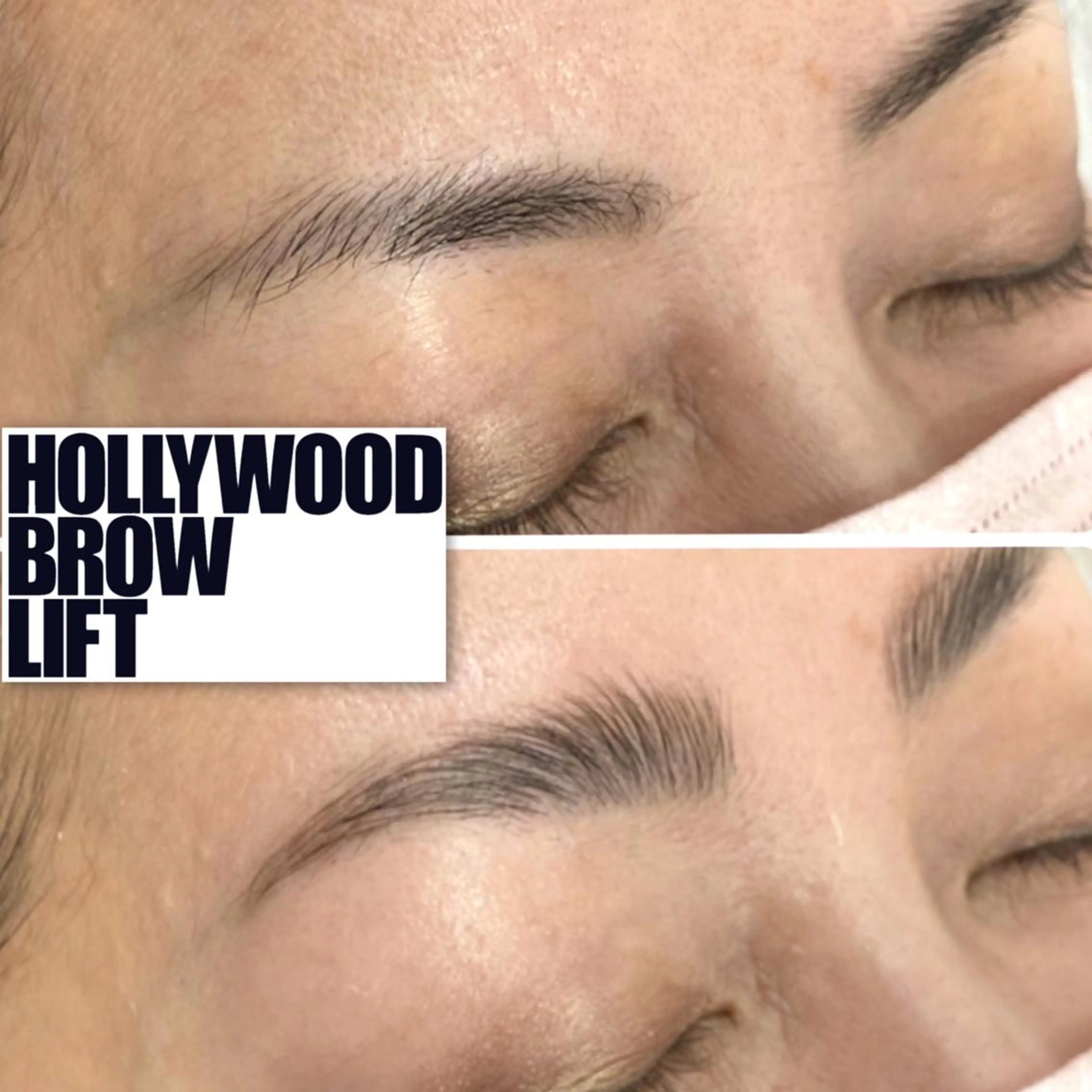 アイブロウ epismoo 脱毛/HBL/毛穴の眉毛・アイブロウイメージ