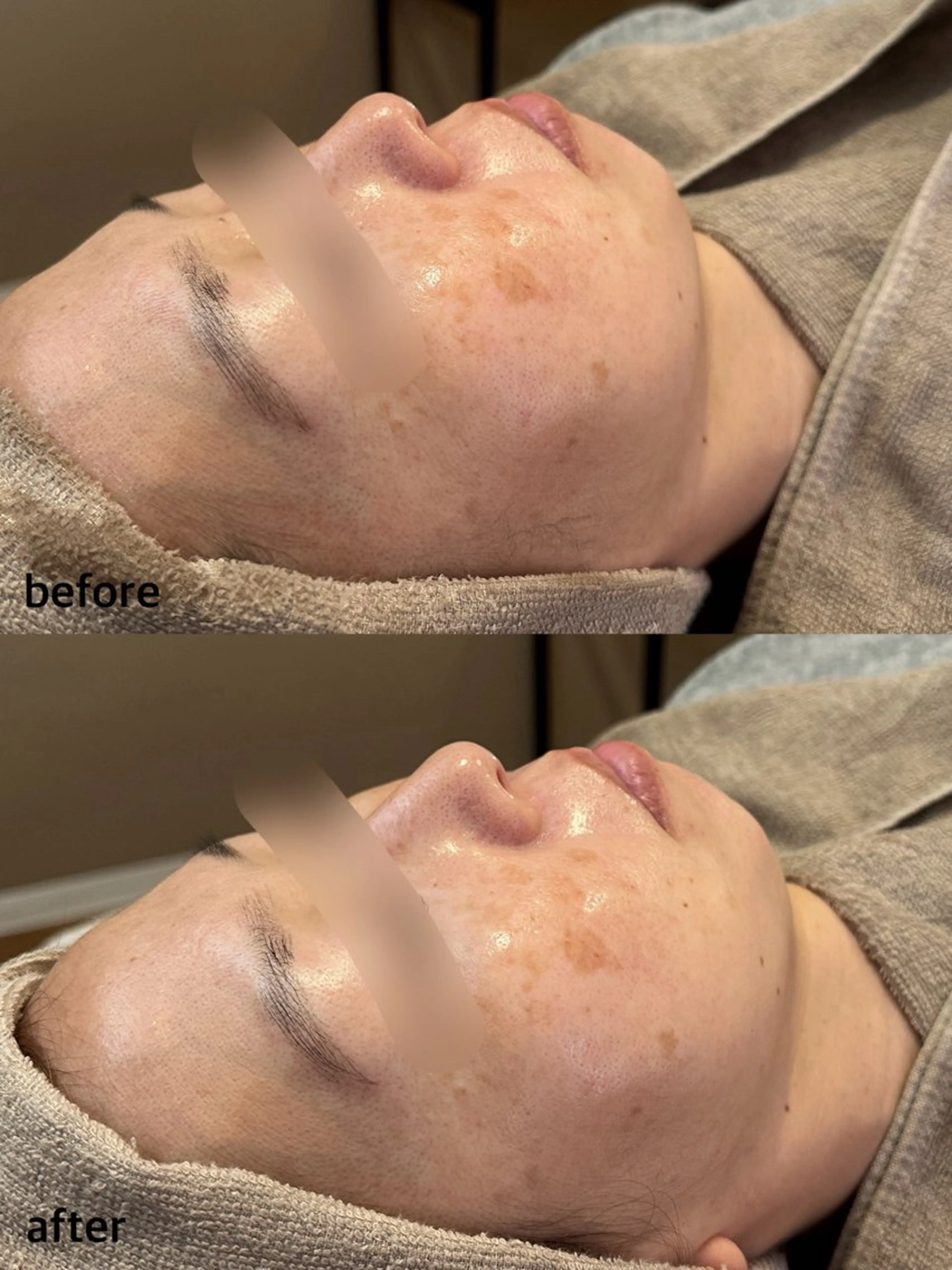 エステ Lassy aoiのマツエク・マツパデザイン