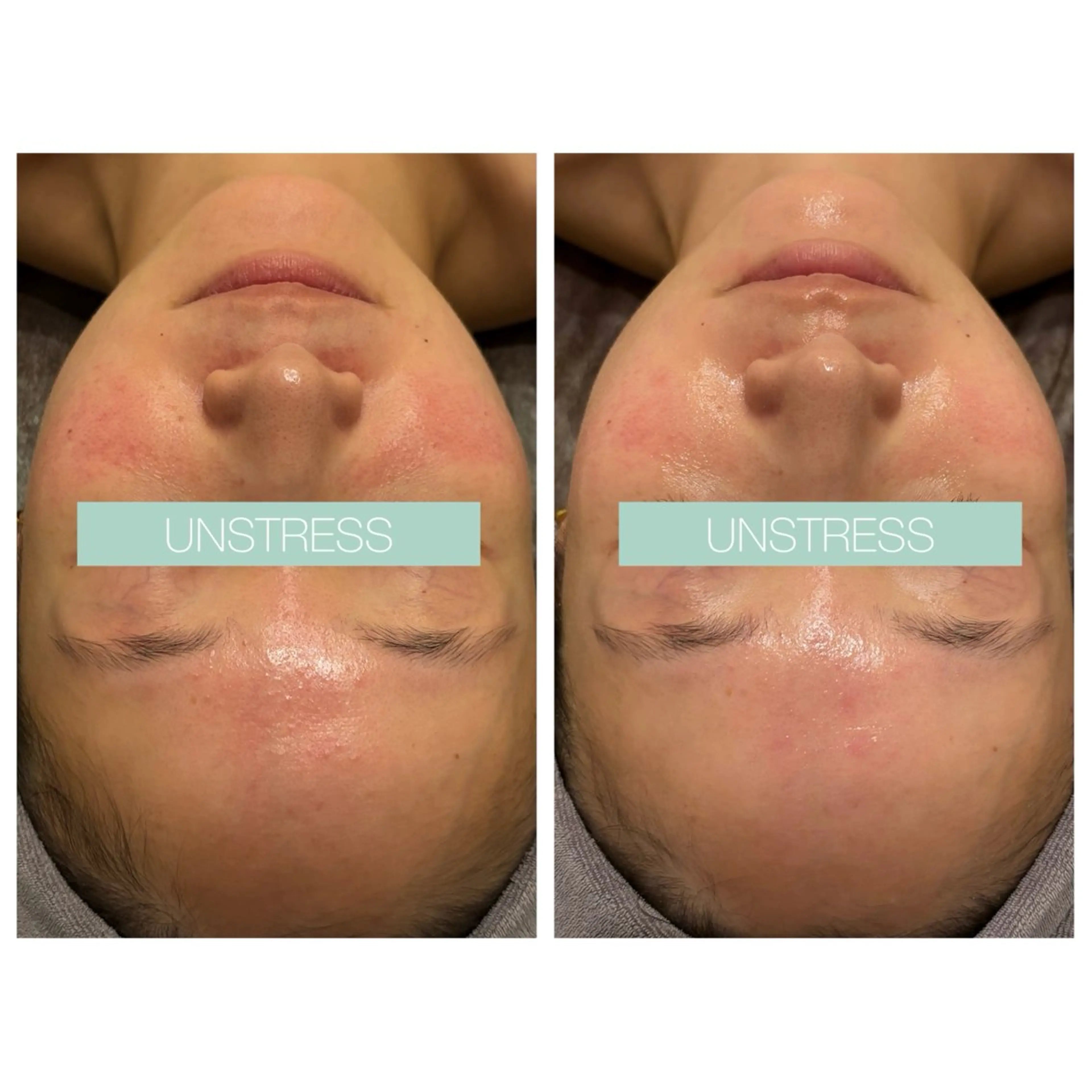 小顔コルギ ☆表参道/外苑前のエステ・リラクイメージ